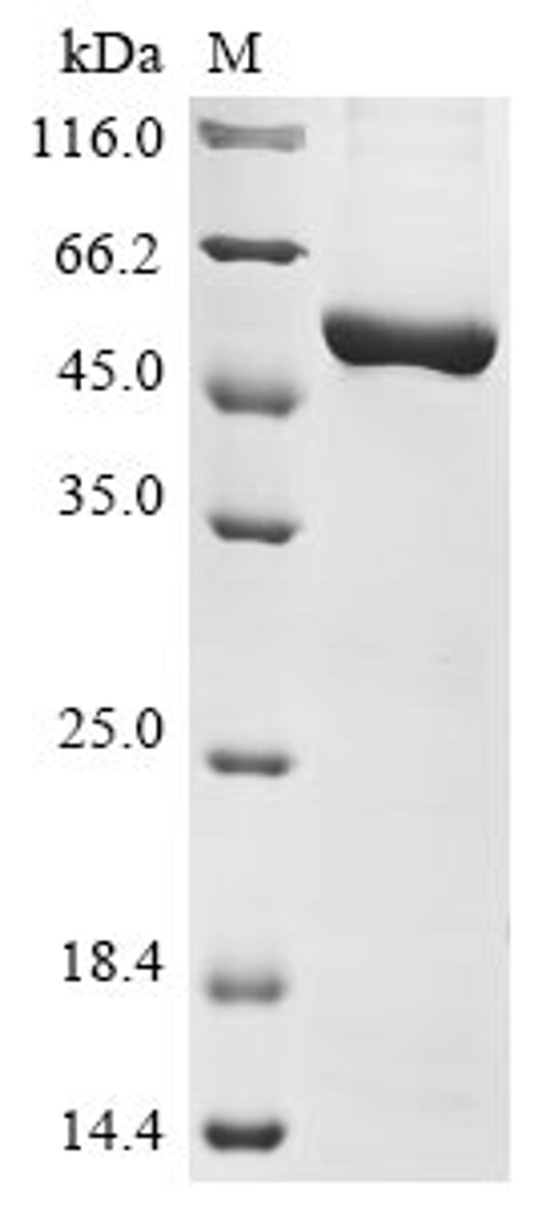 (Tris-Glycine gel) Discontinuous SDS-PAGE (reduced) with 5% enrichment gel and 15% separation gel.
