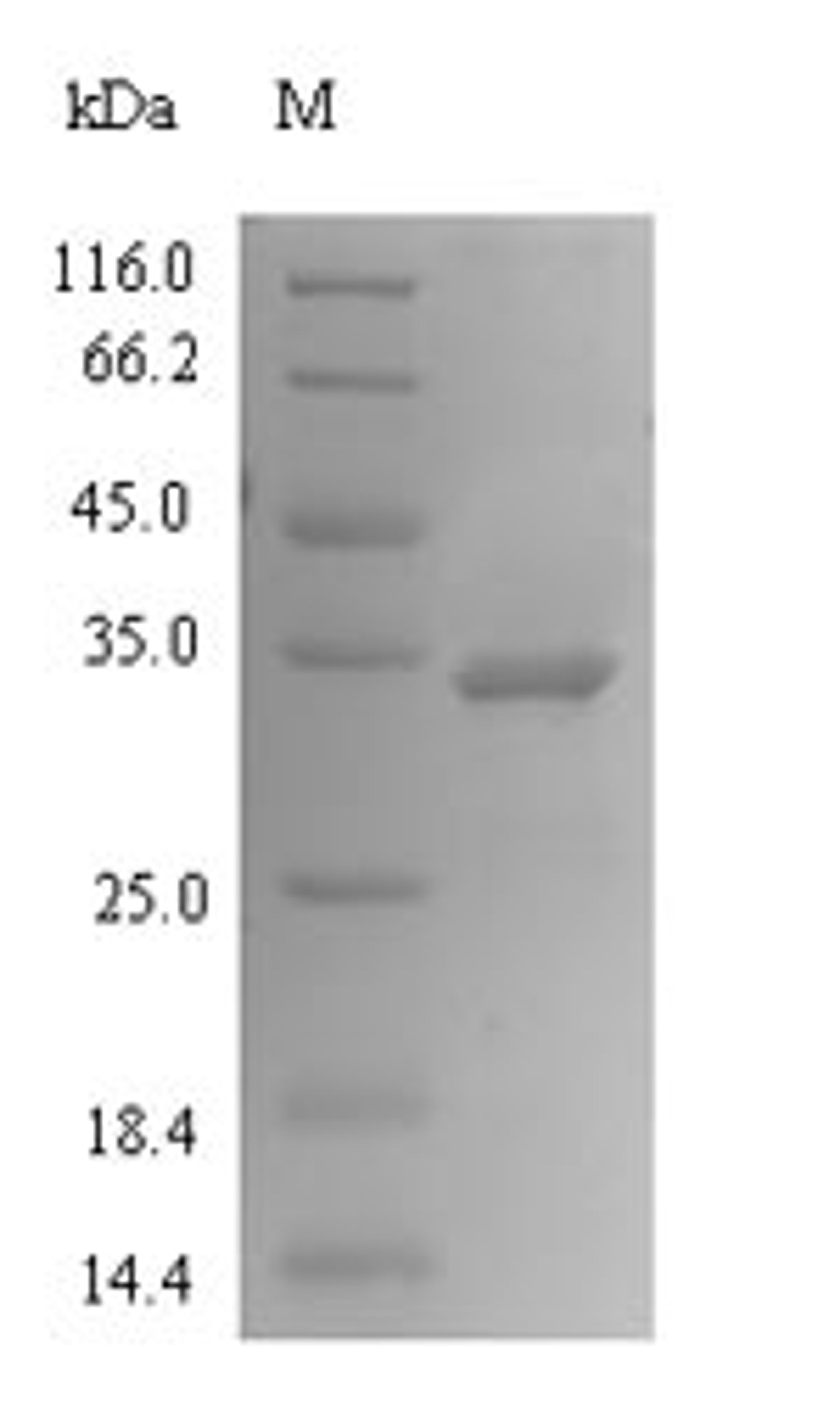 (Tris-Glycine gel) Discontinuous SDS-PAGE (reduced) with 5% enrichment gel and 15% separation gel.