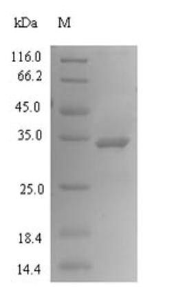(Tris-Glycine gel) Discontinuous SDS-PAGE (reduced) with 5% enrichment gel and 15% separation gel.