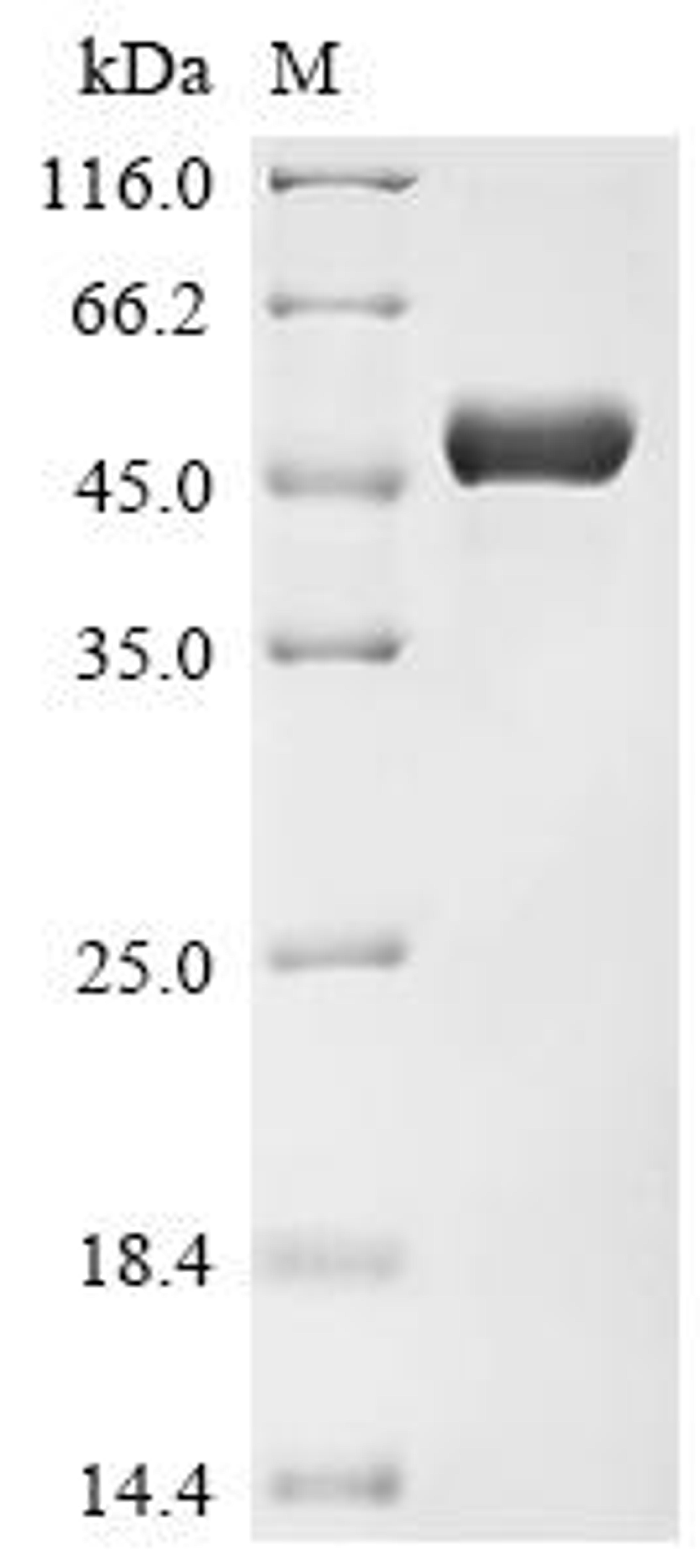 (Tris-Glycine gel) Discontinuous SDS-PAGE (reduced) with 5% enrichment gel and 15% separation gel.