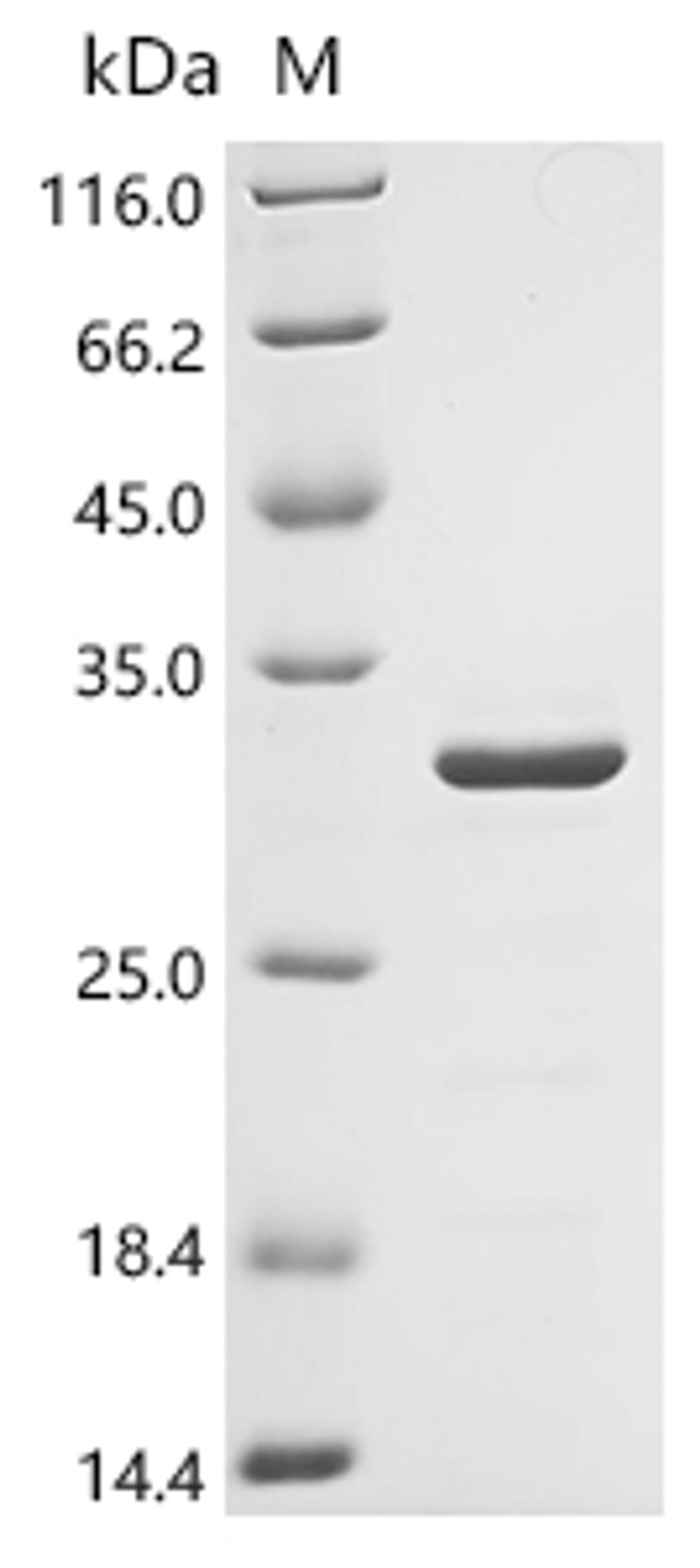 (Tris-Glycine gel) Discontinuous SDS-PAGE (reduced) with 5% enrichment gel and 15% separation gel.