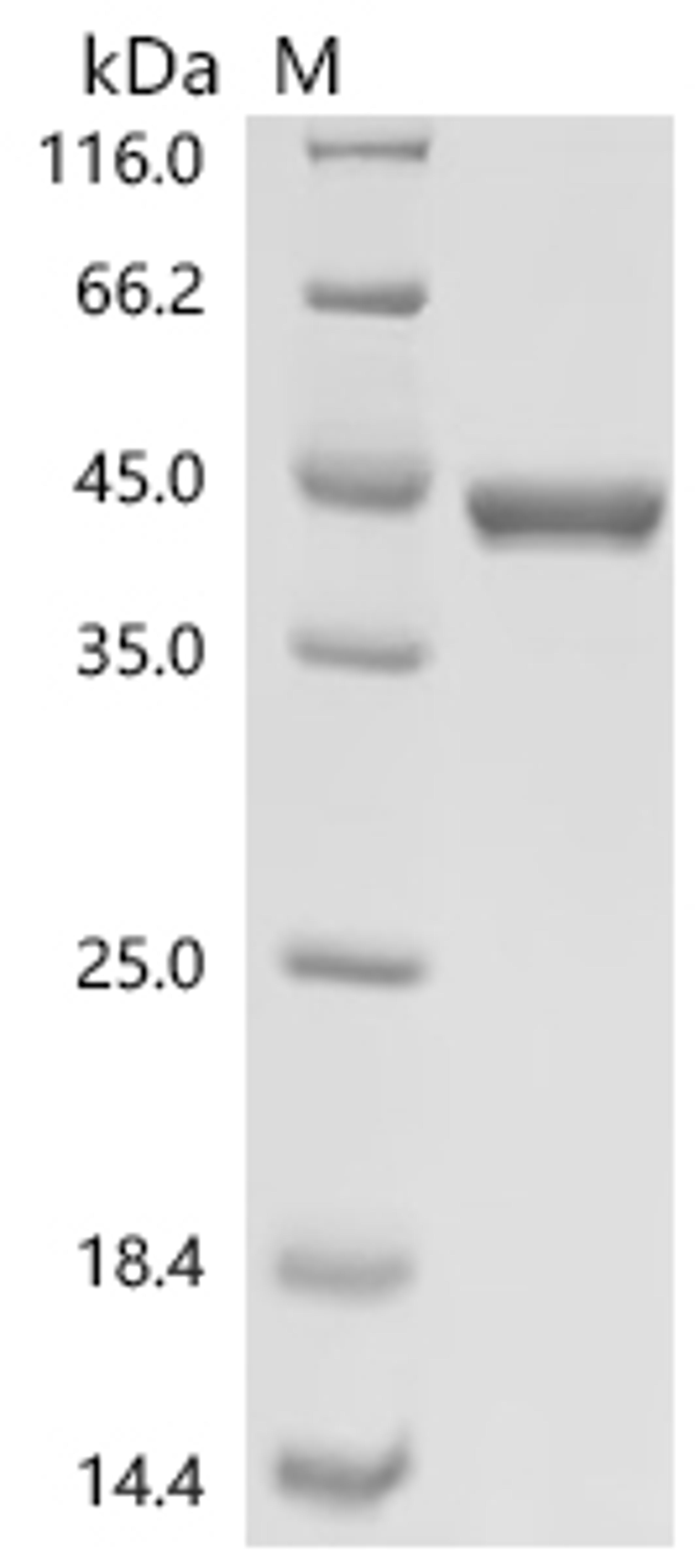 (Tris-Glycine gel) Discontinuous SDS-PAGE (reduced) with 5% enrichment gel and 15% separation gel.
