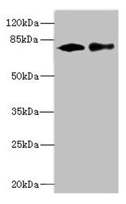 Western blot. All lanes: CALCOCO1 antibody at 1.61µg/ml. Lane 1: 293T whole cell lysate. Lane 2: MCF-7 whole cell lysate. Secondary. Goat polyclonal to rabbit IgG at 1/10000 dilution. Predicted band size: 78, 71, 68 kDa. Observed band size: 78 kDa