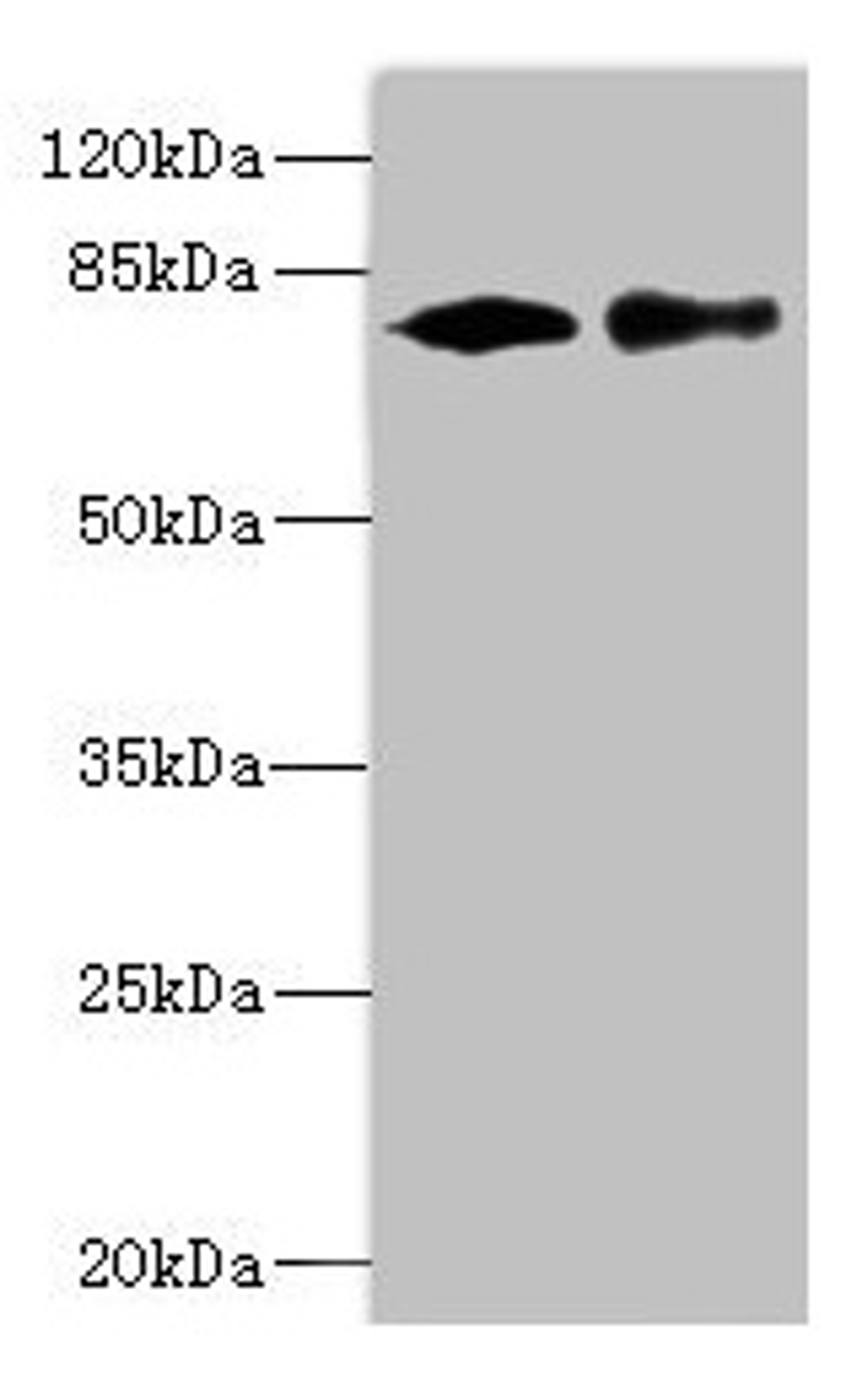 Western blot. All lanes: CALCOCO1 antibody at 1.61µg/ml. Lane 1: 293T whole cell lysate. Lane 2: MCF-7 whole cell lysate. Secondary. Goat polyclonal to rabbit IgG at 1/10000 dilution. Predicted band size: 78, 71, 68 kDa. Observed band size: 78 kDa