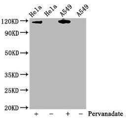 Western Blot. Positive WB detected in Hela whole cell lysate,A549 whole cell lysate(treated with Pervanadate or not). All lanes Phospho-JAK2 antibody at 0.75μg/ml. Secondary. Goat polyclonal to rabbit IgG at 1/50000 dilution. Predicted band size: 120 KDa. Observed band size: 120 KDa.