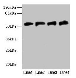 Western blot. All lanes: FDXR antibody at 6µg/ml. Lane 1: A549 whole cell lysate. Lane 2: Mouse liver tissue. Lane 3: HepG2 whole cell lysate. Lane 4: U251 whole cell lysate. Secondary. Goat polyclonal to rabbit IgG at 1/10000 dilution. Predicted band size: 54, 55, 59, 49, 53, 50, 58 kDa. Observed band size: 54 kDa