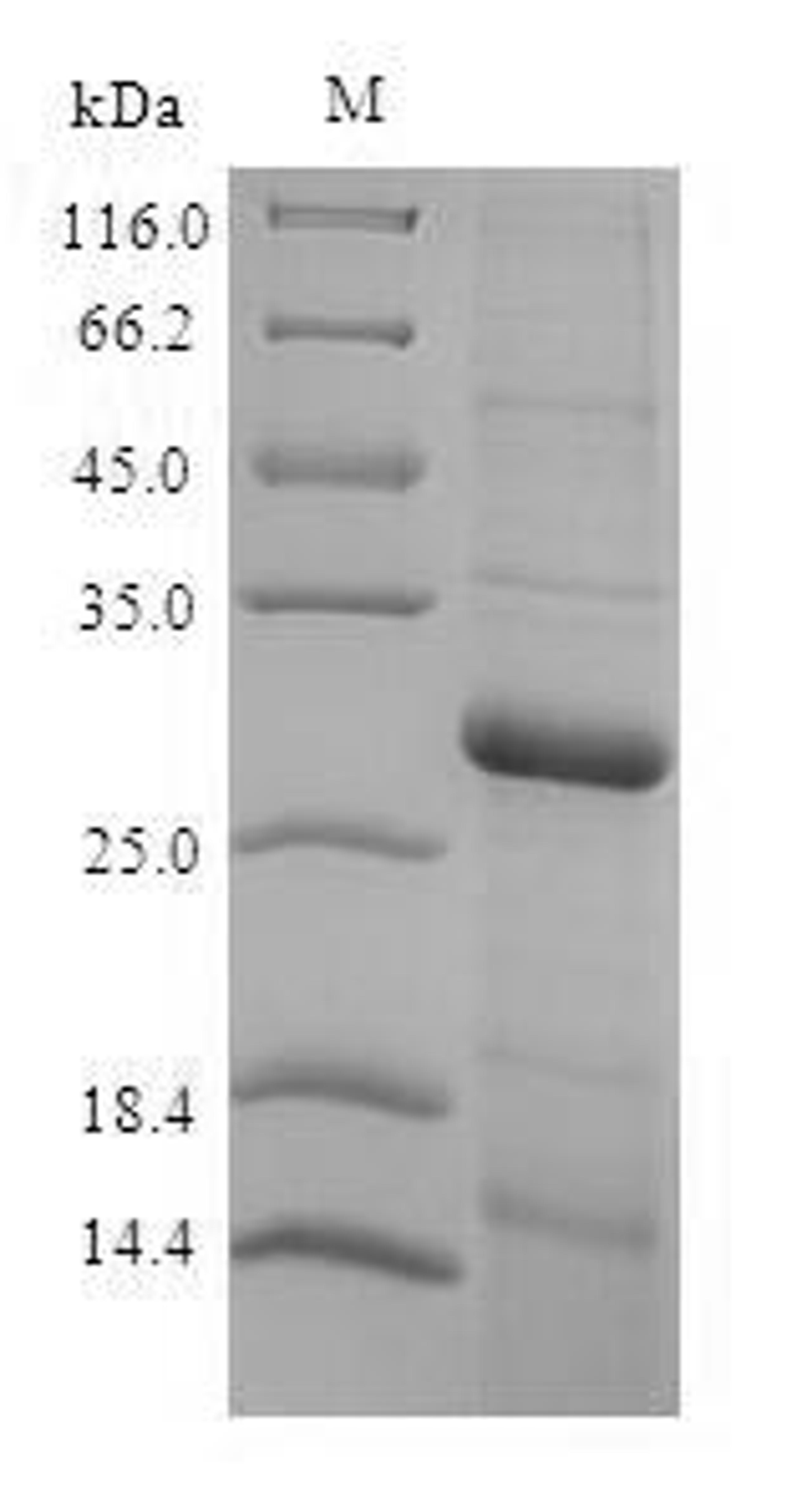 (Tris-Glycine gel) Discontinuous SDS-PAGE (reduced) with 5% enrichment gel and 15% separation gel.