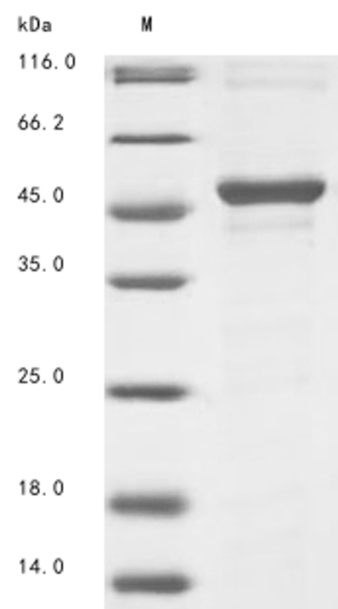 (Tris-Glycine gel) Discontinuous SDS-PAGE (reduced) with 5% enrichment gel and 15% separation gel.