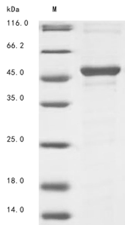 (Tris-Glycine gel) Discontinuous SDS-PAGE (reduced) with 5% enrichment gel and 15% separation gel.
