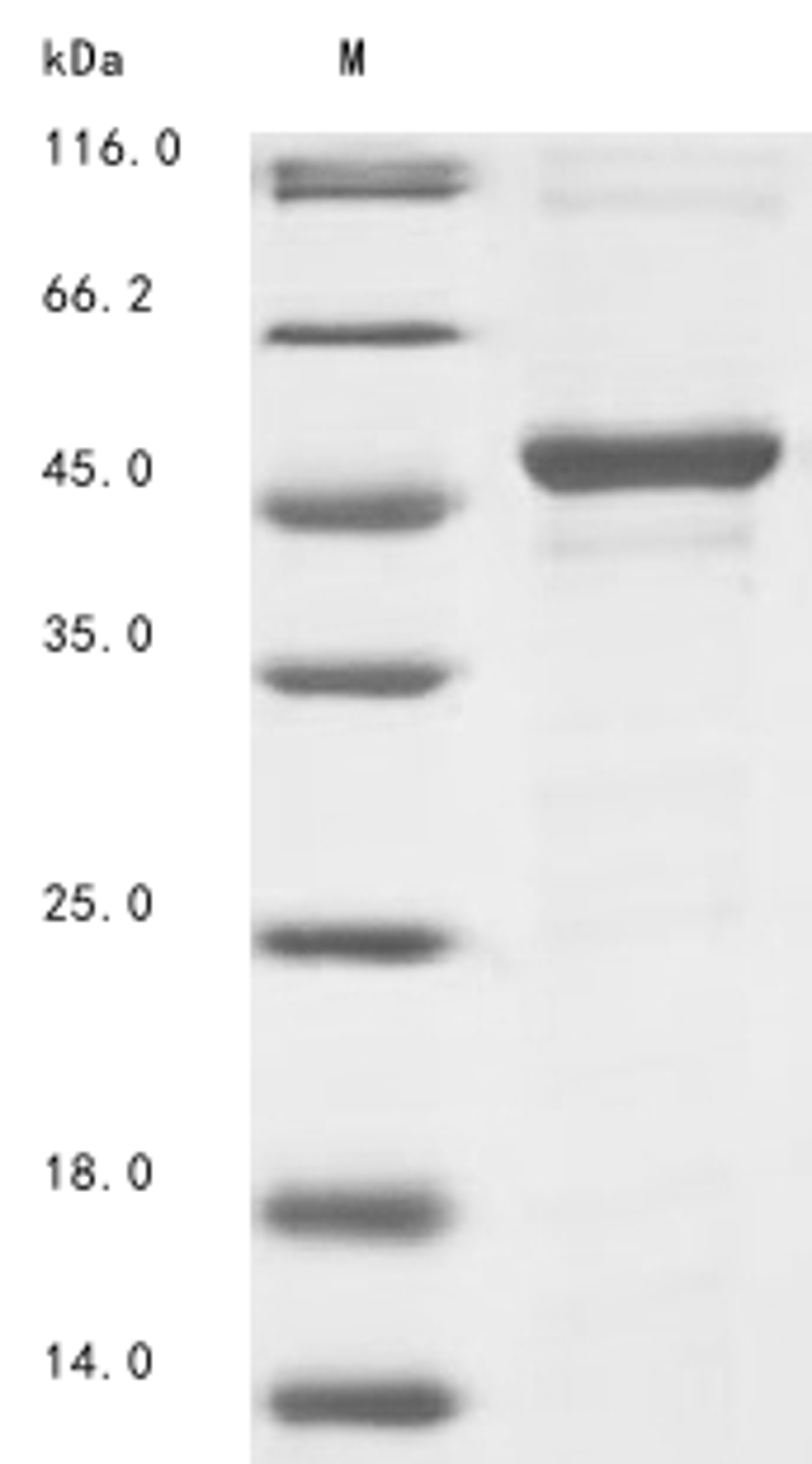 (Tris-Glycine gel) Discontinuous SDS-PAGE (reduced) with 5% enrichment gel and 15% separation gel.
