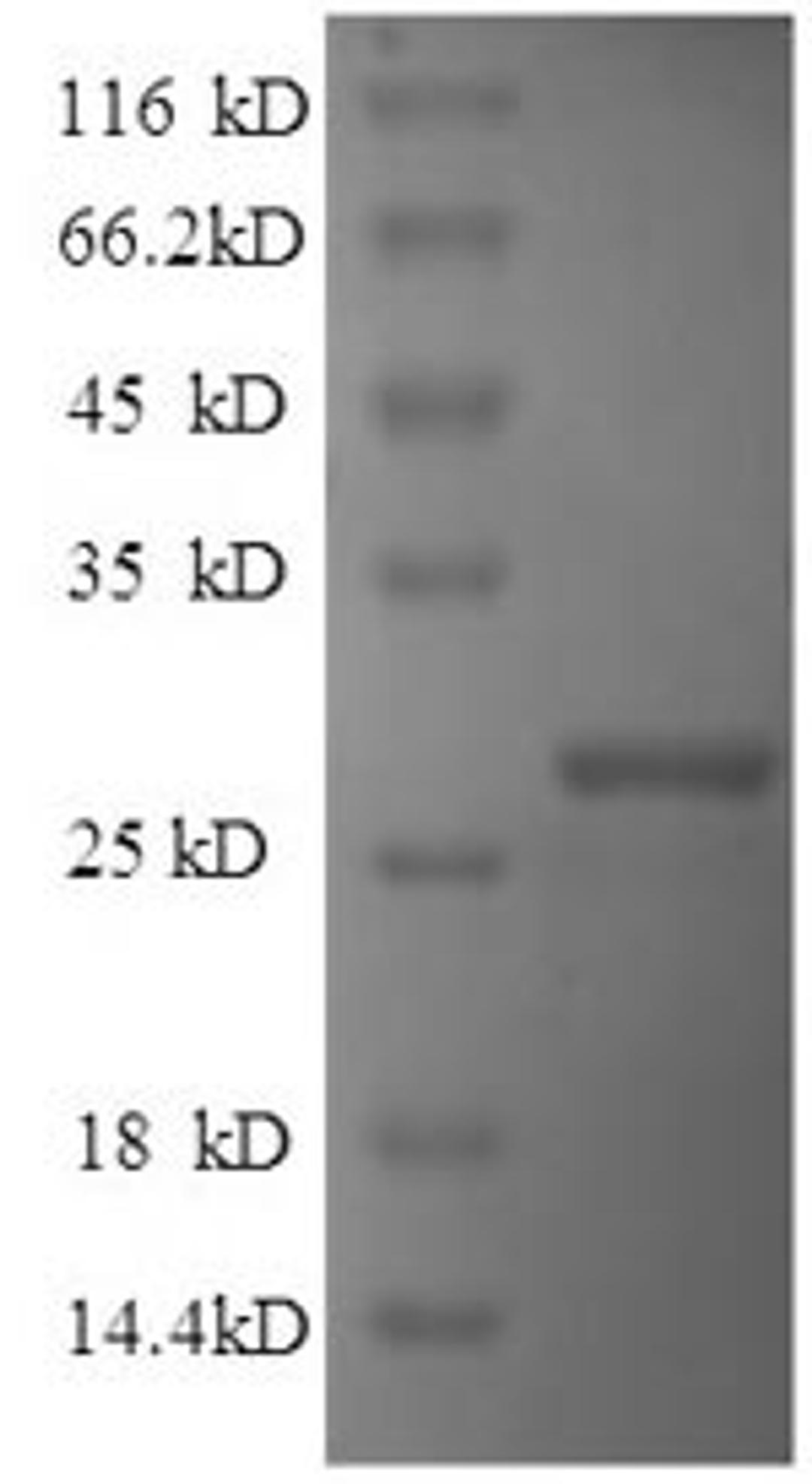 (Tris-Glycine gel) Discontinuous SDS-PAGE (reduced) with 5% enrichment gel and 15% separation gel.