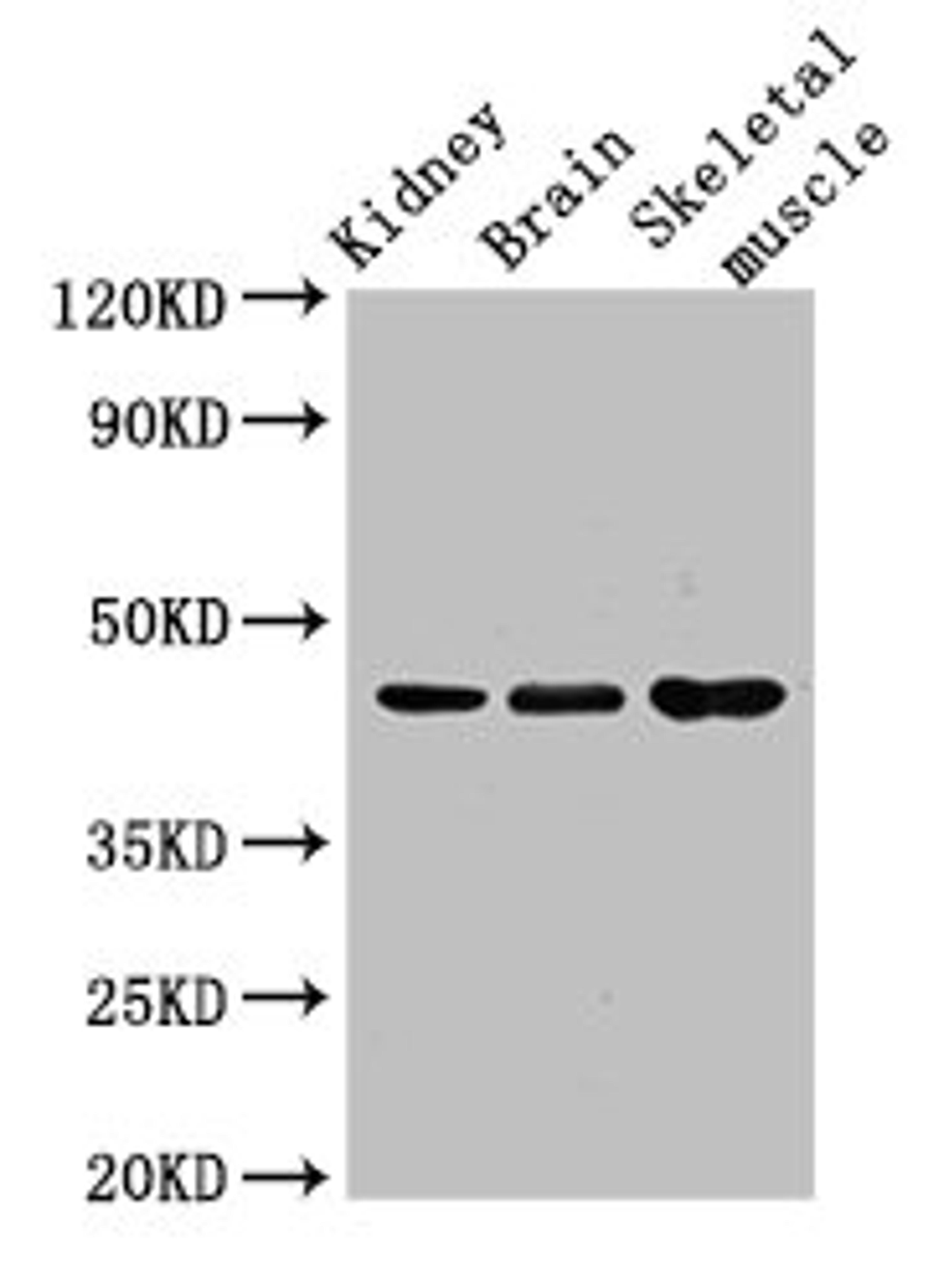Western Blot. Positive WB detected in: Mouse kidney tissue, Mouse brain tissue, Mouse skeletal muscle tissue. All lanes: CASP4 antibody at 3.5ug/ml. Secondary. Goat polyclonal to rabbit IgG at 1/50000 dilution. Predicted band size: 44, 37, 14, 31, 19 kDa. Observed band size: 44 kDa. 