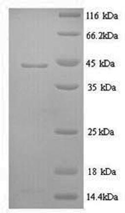 (Tris-Glycine gel) Discontinuous SDS-PAGE (reduced) with 5% enrichment gel and 15% separation gel.