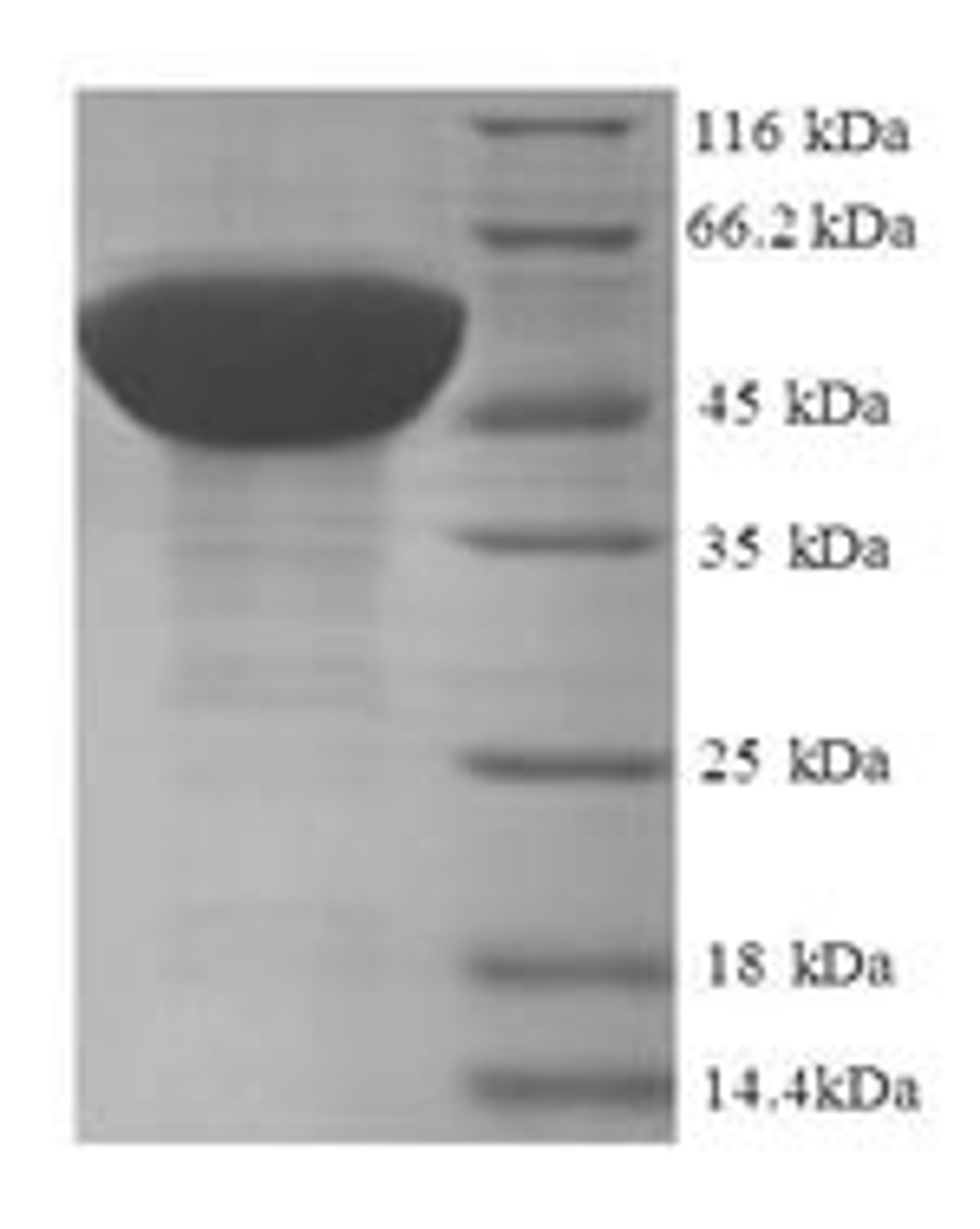 (Tris-Glycine gel) Discontinuous SDS-PAGE (reduced) with 5% enrichment gel and 15% separation gel.