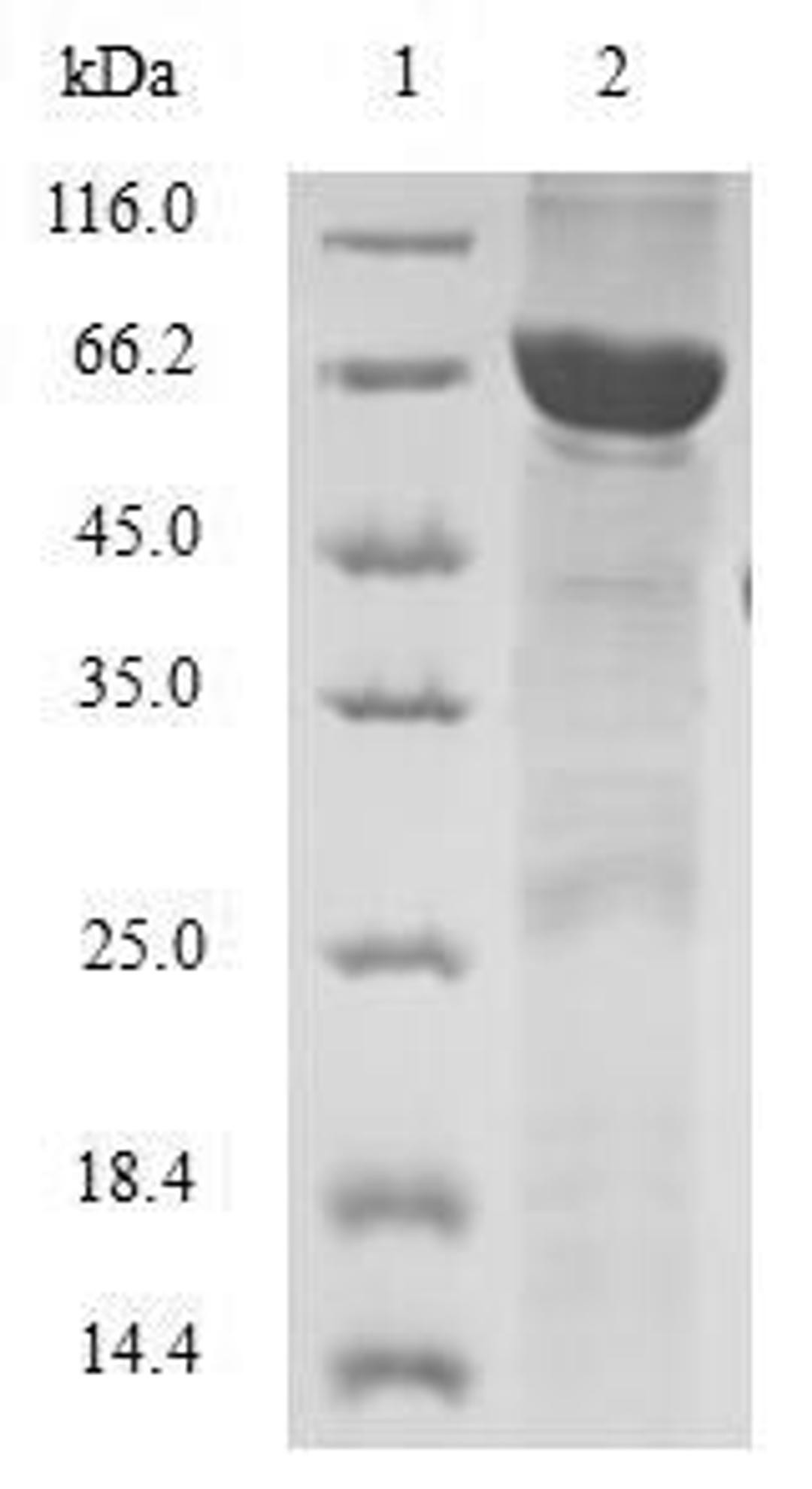 (Tris-Glycine gel) Discontinuous SDS-PAGE (reduced) with 5% enrichment gel and 15% separation gel.