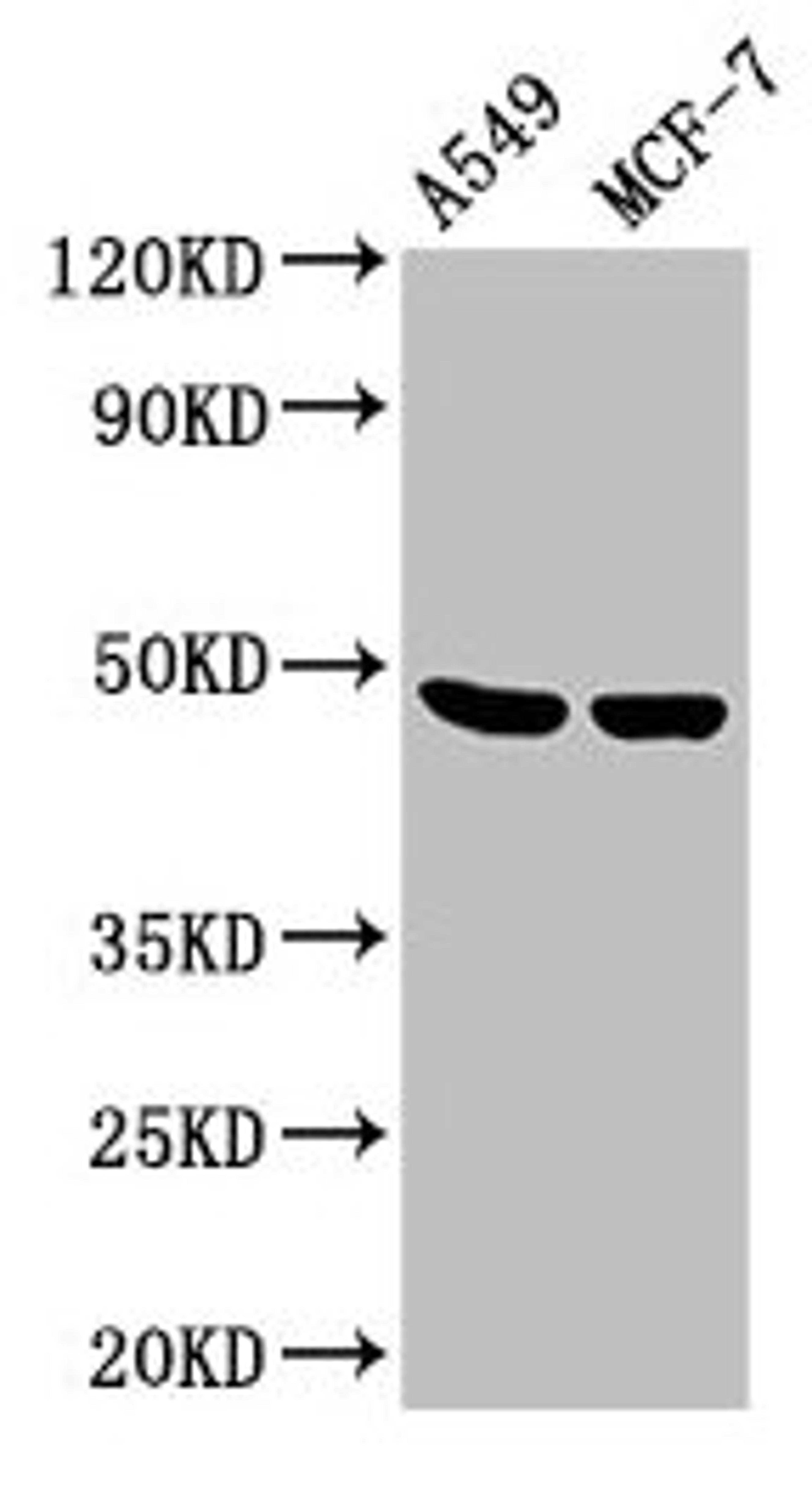 Western Blot. Positive WB detected in: A549 whole cell lysate, MCF-7 whole cell lysate. All lanes: LOX antibody at 3.6µg/ml. Secondary. Goat polyclonal to rabbit IgG at 1/50000 dilution. Predicted band size: 47 kDa. Observed band size: 47 kDa