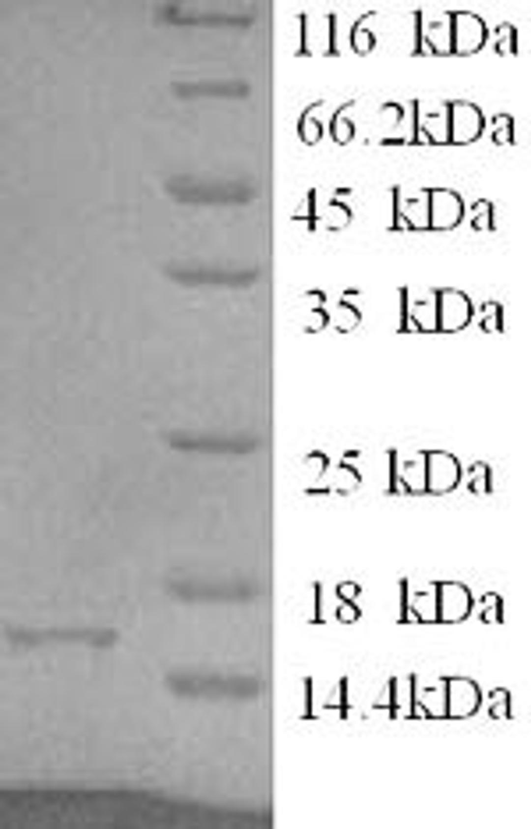 (Tris-Glycine gel) Discontinuous SDS-PAGE (reduced) with 5% enrichment gel and 15% separation gel.