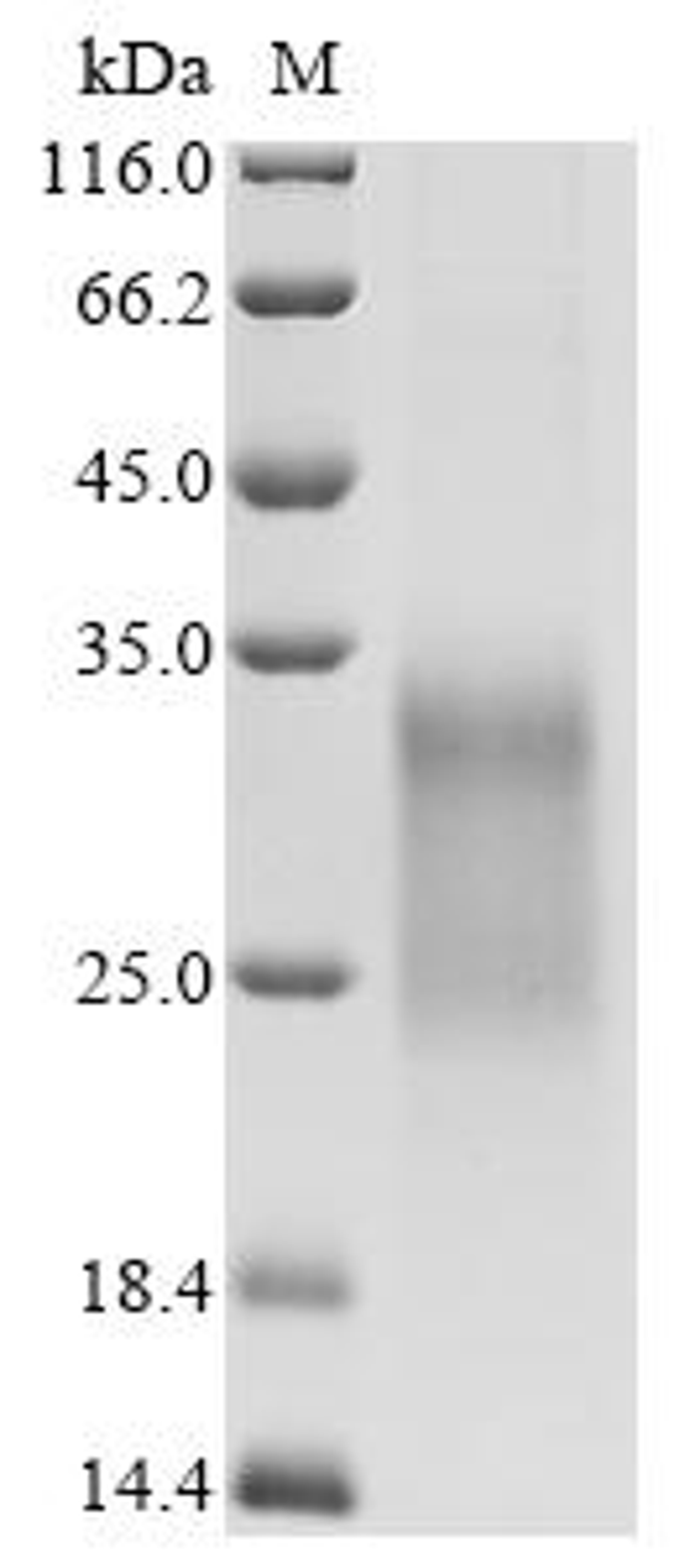 (Tris-Glycine gel) Discontinuous SDS-PAGE (reduced) with 5% enrichment gel and 15% separation gel.