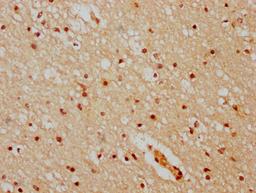 IHC image of CSB-PA010378OA51nhibHU diluted at 1:20 and staining in paraffin-embedded human brain tissue performed on a Leica BondTM system. After dewaxing and hydration, antigen retrieval was mediated by high pressure in a citrate buffer (pH 6.0). Section was blocked with 10% normal goat serum 30min at RT. Then primary antibody (1% BSA) was incubated at 4°C overnight. The primary is detected by a biotinylated secondary antibody and visualized using an HRP conjugated SP system.