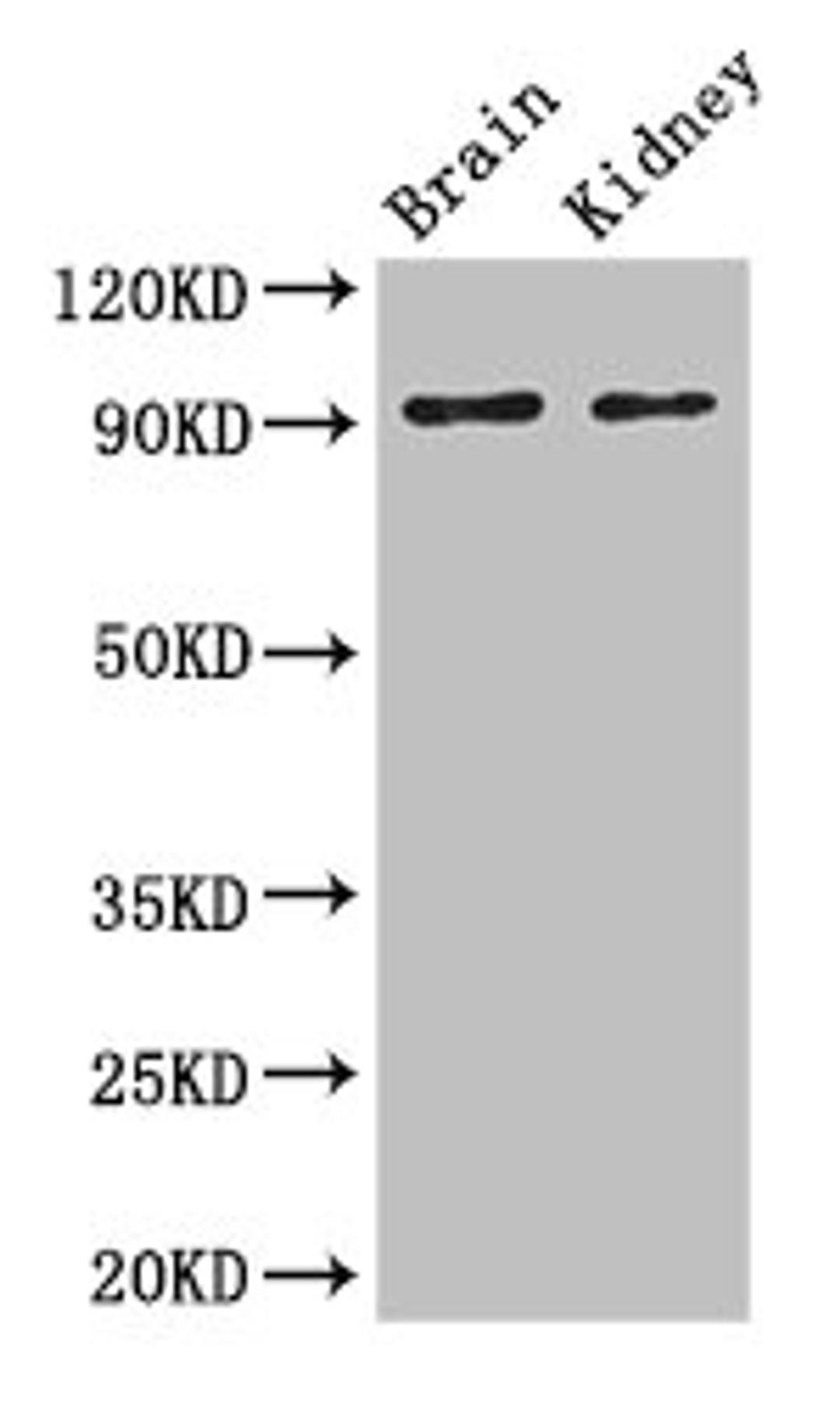 Western Blot. Positive WB detected in: Mouse brain tissue, Mouse kidney tissue. All lanes: SLC9A1 antibody at 3ug/ml. Secondary. Goat polyclonal to rabbit IgG at 1/50000 dilution. Predicted band size: 91, 62 kDa. Observed band size: 91 kDa.