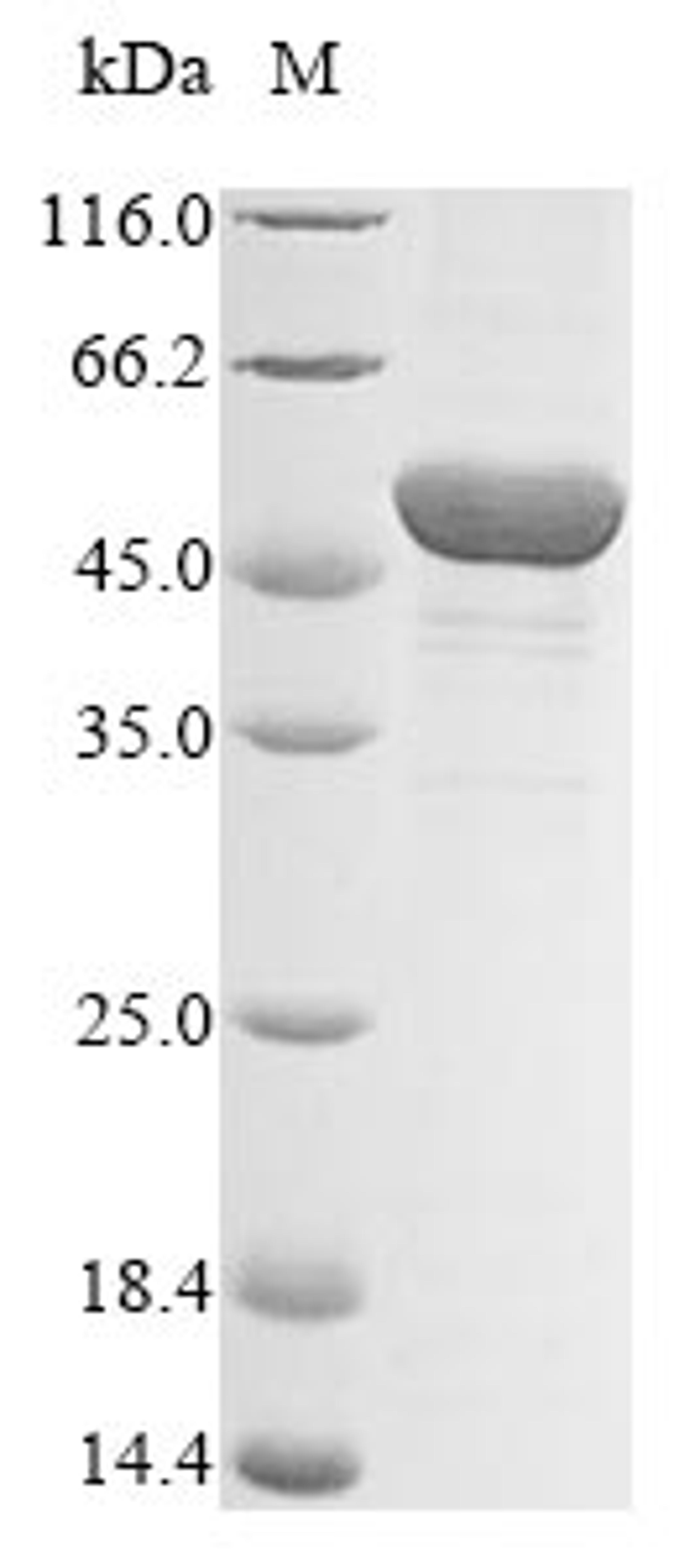 (Tris-Glycine gel) Discontinuous SDS-PAGE (reduced) with 5% enrichment gel and 15% separation gel.