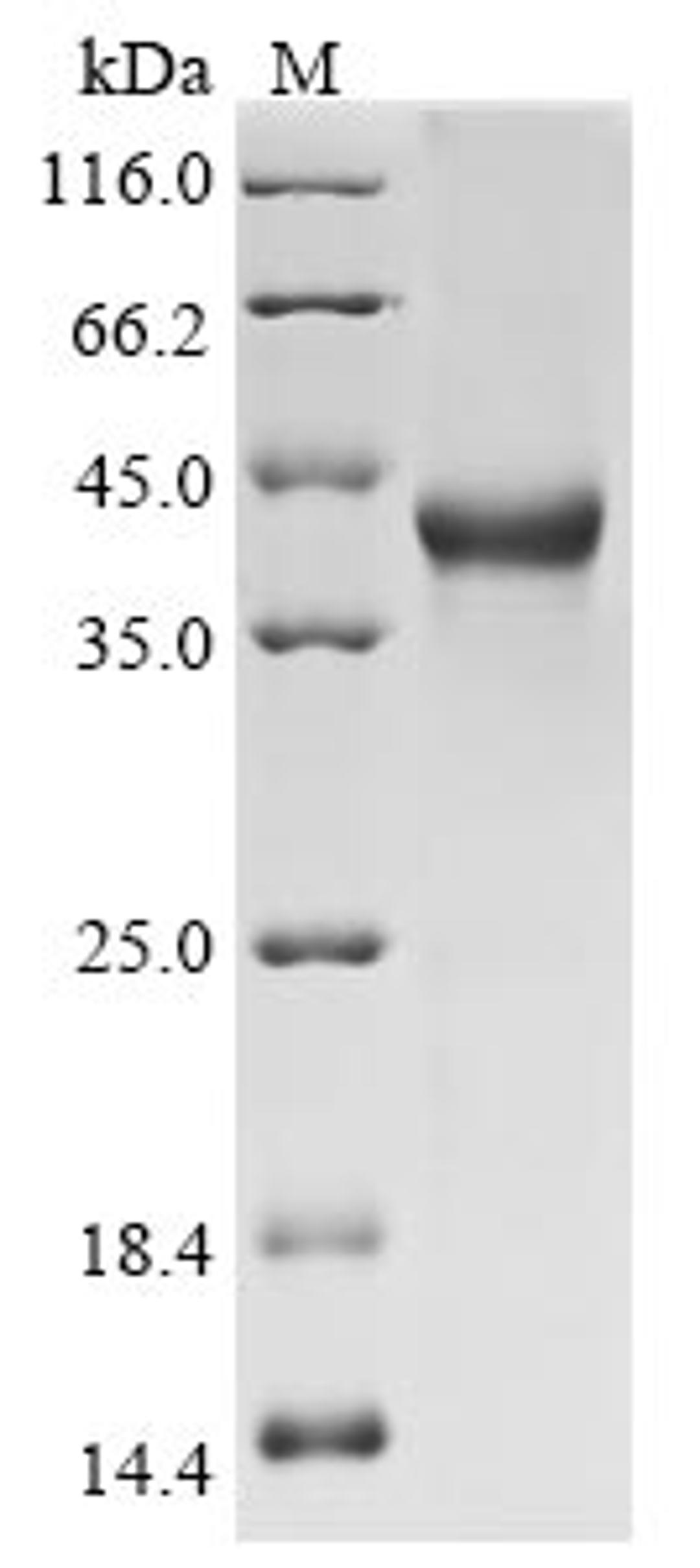 (Tris-Glycine gel) Discontinuous SDS-PAGE (reduced) with 5% enrichment gel and 15% separation gel.