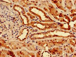 Immunohistochemistry of paraffin-embedded human kidney tissue using CSB-PA021475LA01HU at dilution of 1:100