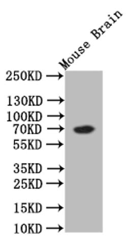 Western Blot. Positive WB detected in: Mouse Brain tissue lysate. All lanes: CHAT antibody at 1:500. Secondary. Goat polyclonal to rabbit IgG at 1/50000 dilution. Predicted band size: 70 kDa. Observed band size: 70 kDa.