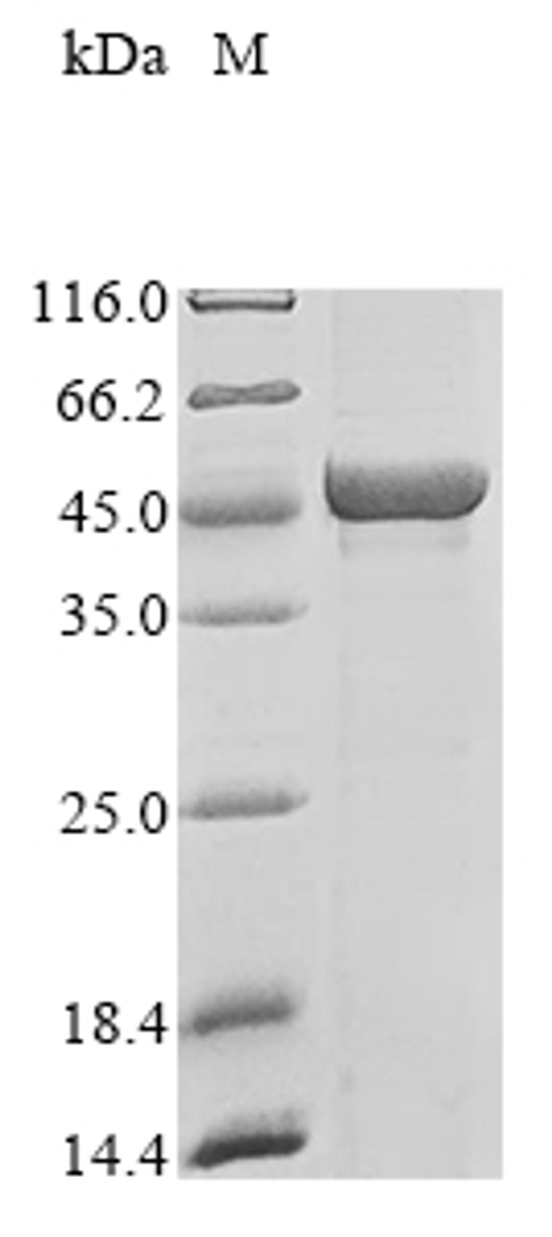 (Tris-Glycine gel) Discontinuous SDS-PAGE (reduced) with 5% enrichment gel and 15% separation gel.