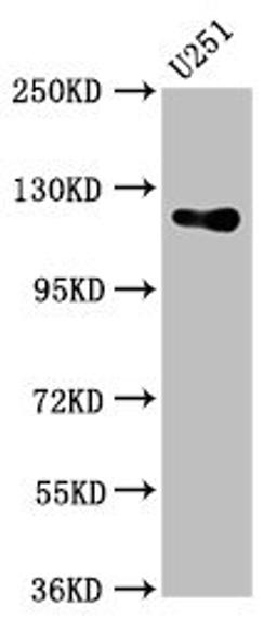 Western Blot. Positive WB detected in: U251 whole cell lysate. All lanes: GUCY2D antibody at 5.4µg/ml. Secondary. Goat polyclonal to rabbit IgG at 1/50000 dilution. Predicted band size: 121 kDa. Observed band size: 121 kDa