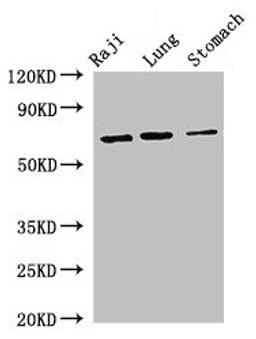 Western Blot. Positive WB detected in: Raji whole cell lysate, Mouse lung tissue, Mouse stomach tissue. All lanes: FOXN1 antibody at 2.7µg/ml. Secondary. Goat polyclonal to rabbit IgG at 1/50000 dilution. Predicted band size: 69 kDa. Observed band size: 69 kDa