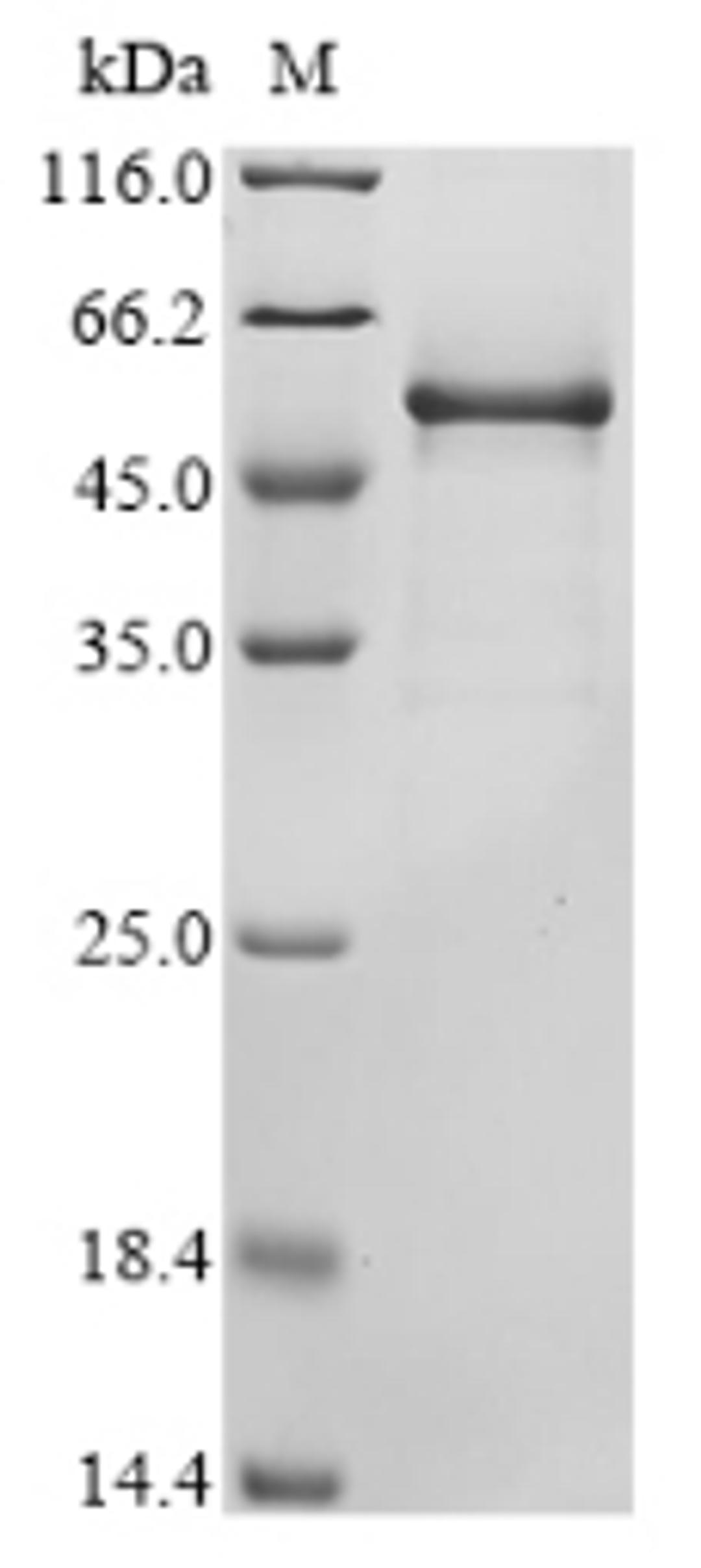 (Tris-Glycine gel) Discontinuous SDS-PAGE (reduced) with 5% enrichment gel and 15% separation gel.