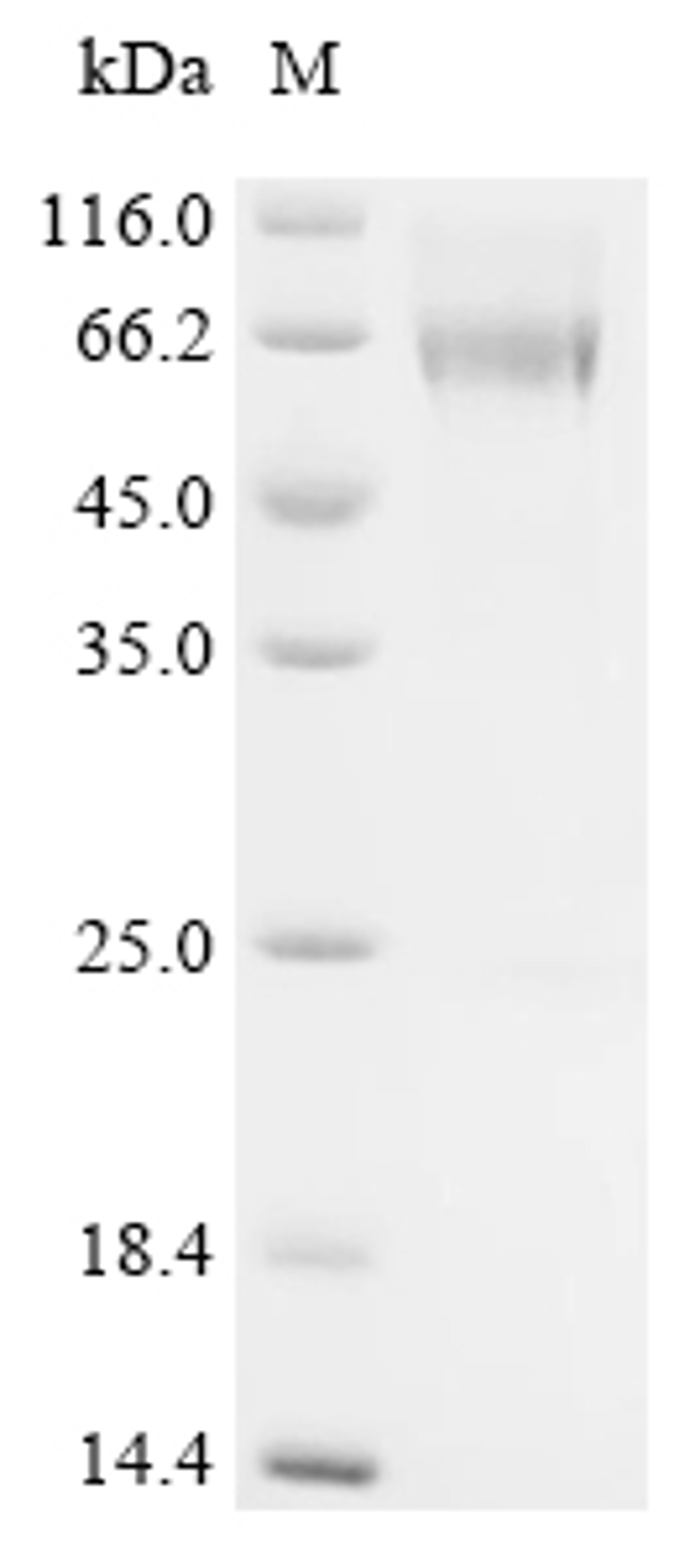 (Tris-Glycine gel) Discontinuous SDS-PAGE (reduced) with 5% enrichment gel and 15% separation gel.
