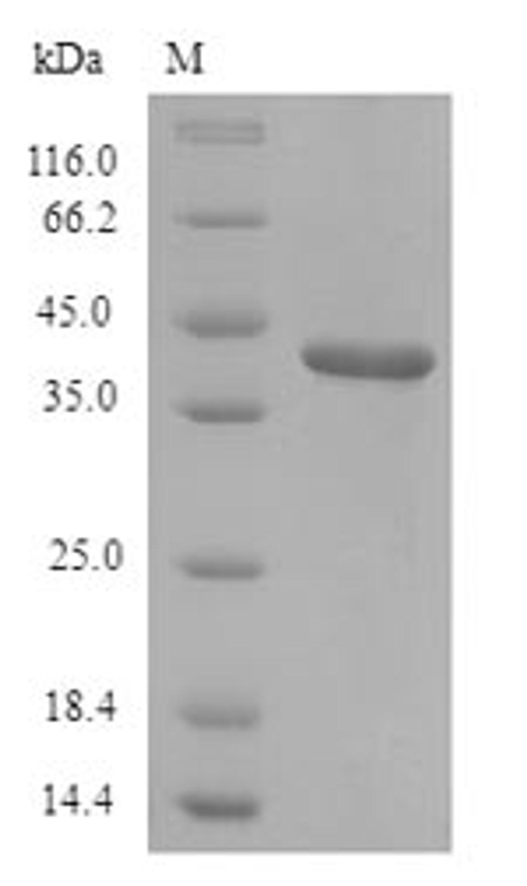 (Tris-Glycine gel) Discontinuous SDS-PAGE (reduced) with 5% enrichment gel and 15% separation gel.
