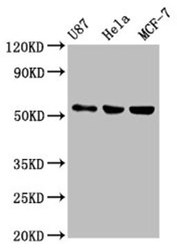 Western Blot. Positive WB detected in: U87 whole cell lysate, Hela whole cell lysate, MCF-7 whole cell lysate. All lanes: MEF2A antibody at 1:500. Secondary. Goat polyclonal to rabbit IgG at 1/50000 dilution. Predicted band size: 55, 54, 47, 46 kDa. Observed band size: 55 kDa. 