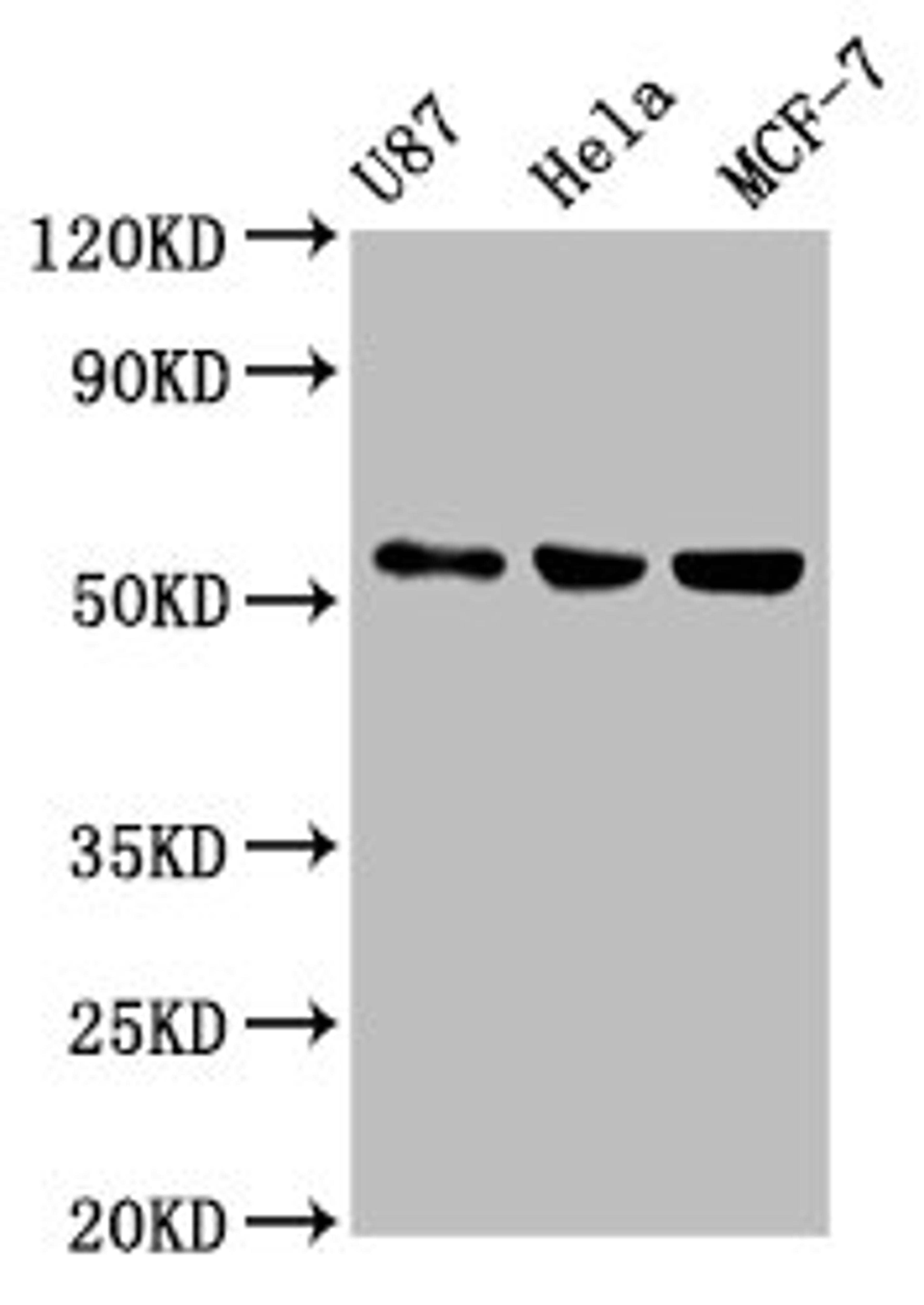 Western Blot. Positive WB detected in: U87 whole cell lysate, Hela whole cell lysate, MCF-7 whole cell lysate. All lanes: MEF2A antibody at 1:500. Secondary. Goat polyclonal to rabbit IgG at 1/50000 dilution. Predicted band size: 55, 54, 47, 46 kDa. Observed band size: 55 kDa. 
