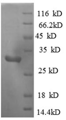 (Tris-Glycine gel) Discontinuous SDS-PAGE (reduced) with 5% enrichment gel and 15% separation gel.