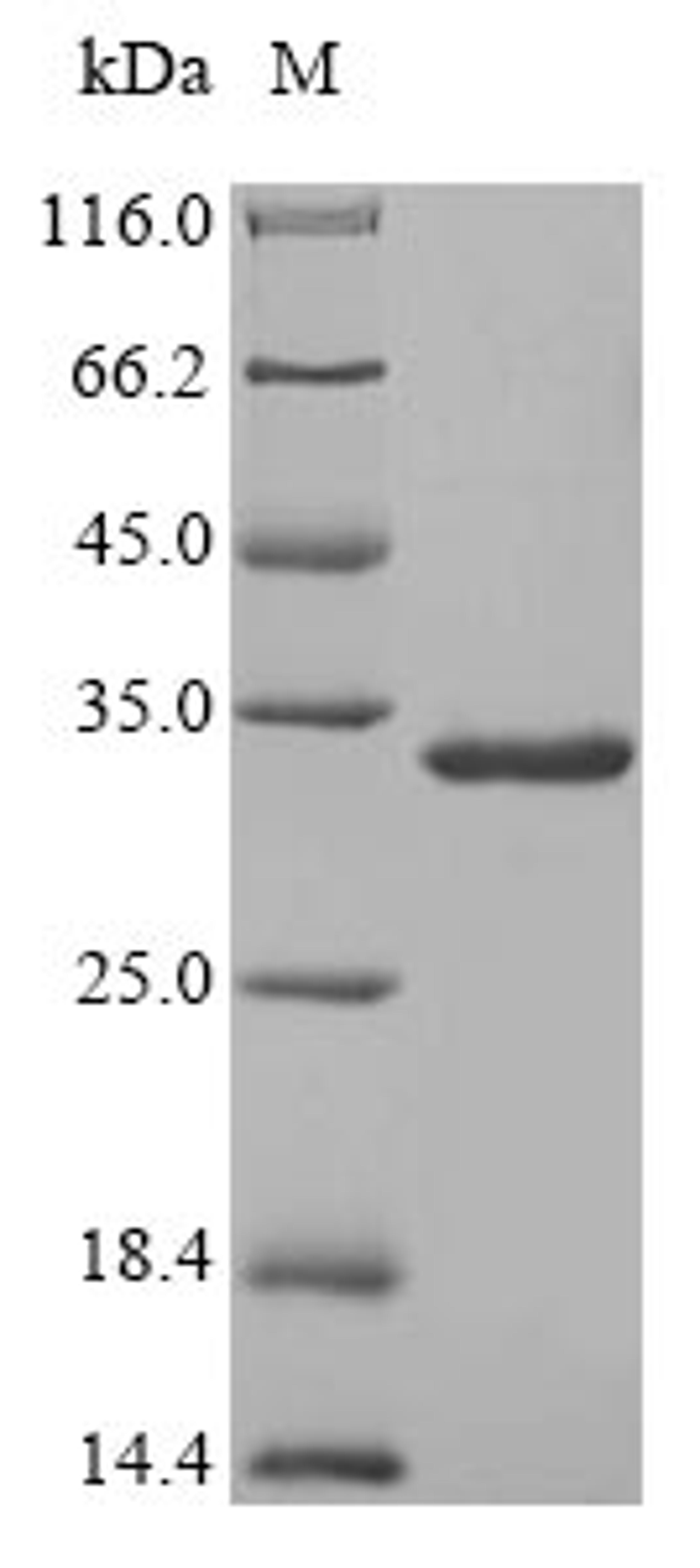 (Tris-Glycine gel) Discontinuous SDS-PAGE (reduced) with 5% enrichment gel and 15% separation gel.