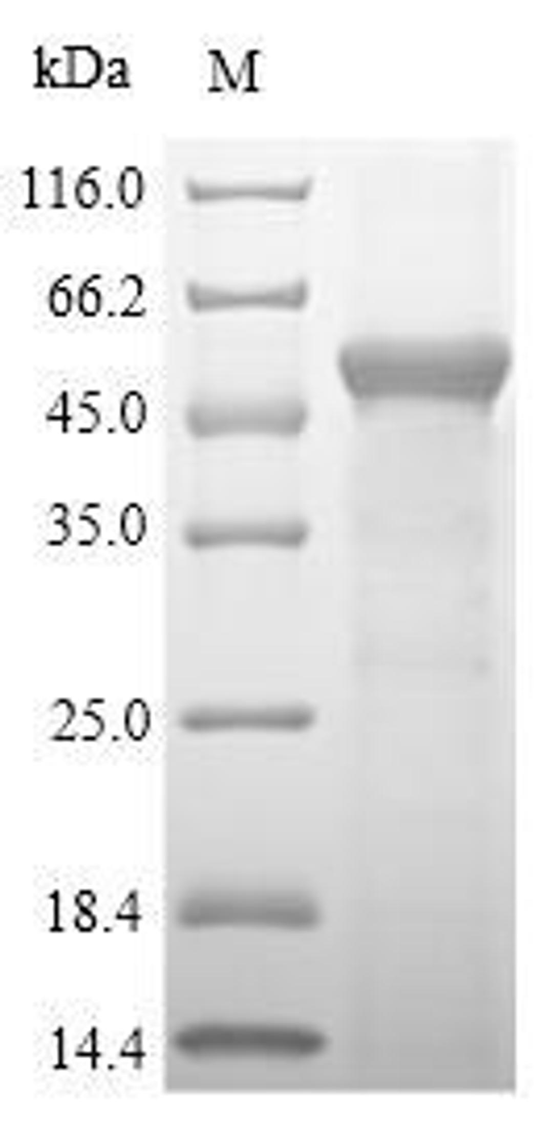 (Tris-Glycine gel) Discontinuous SDS-PAGE (reduced) with 5% enrichment gel and 15% separation gel.