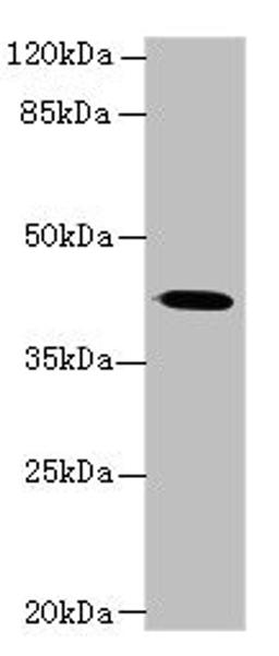 Western blot. All lanes: GNA14 antibody at 3µg/ml + Mouse lung tissue. Secondary. Goat polyclonal to rabbit IgG at 1/10000 dilution. Predicted band size: 42 kDa. Observed band size: 42 kDa