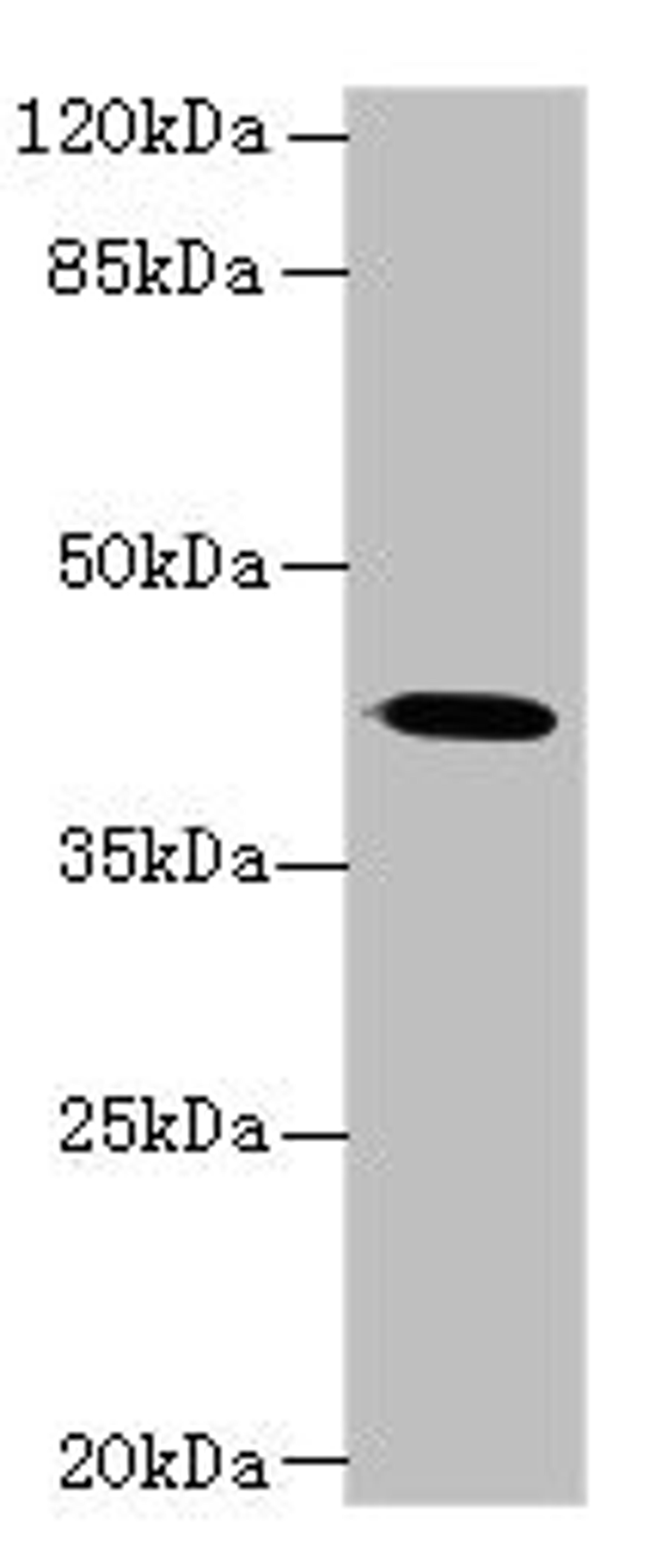Western blot. All lanes: GNA14 antibody at 3µg/ml + Mouse lung tissue. Secondary. Goat polyclonal to rabbit IgG at 1/10000 dilution. Predicted band size: 42 kDa. Observed band size: 42 kDa