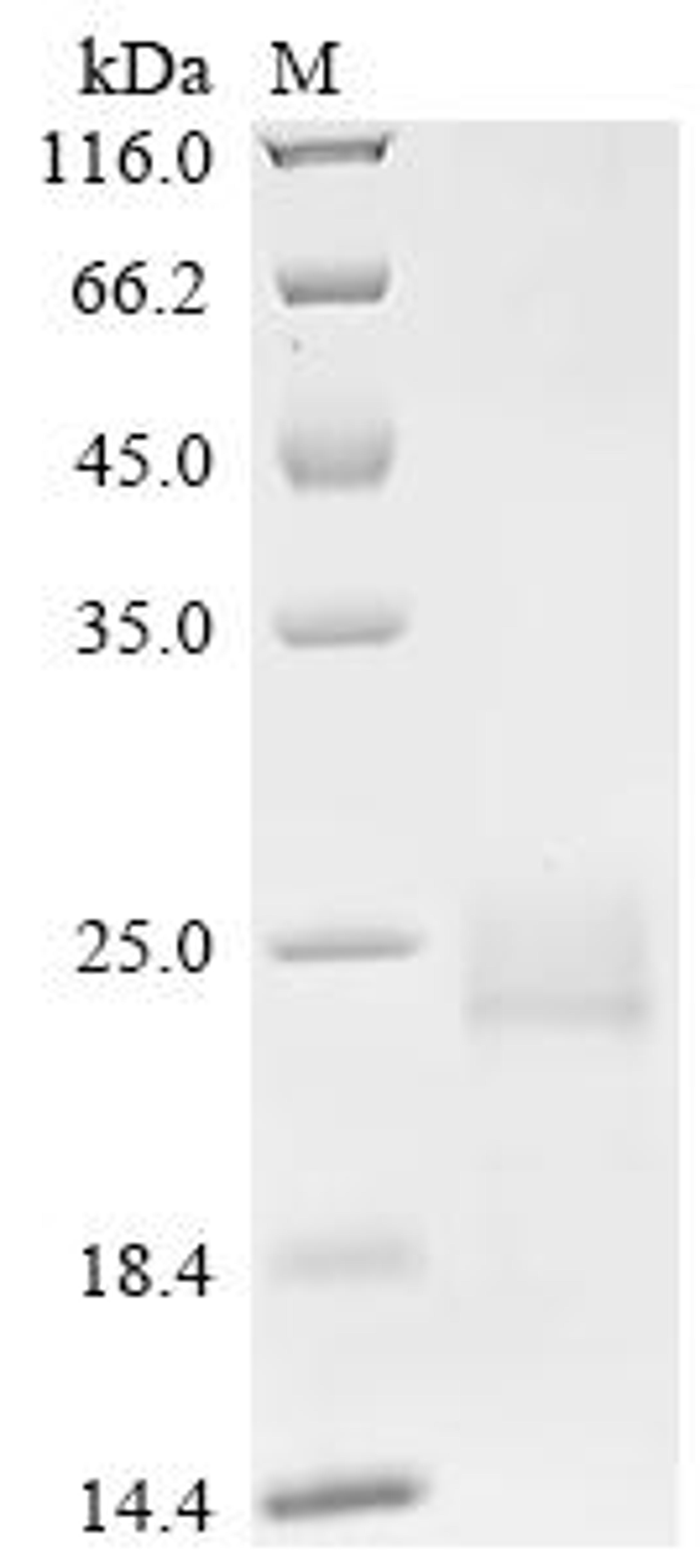 (Tris-Glycine gel) Discontinuous SDS-PAGE (reduced) with 5% enrichment gel and 15% separation gel.