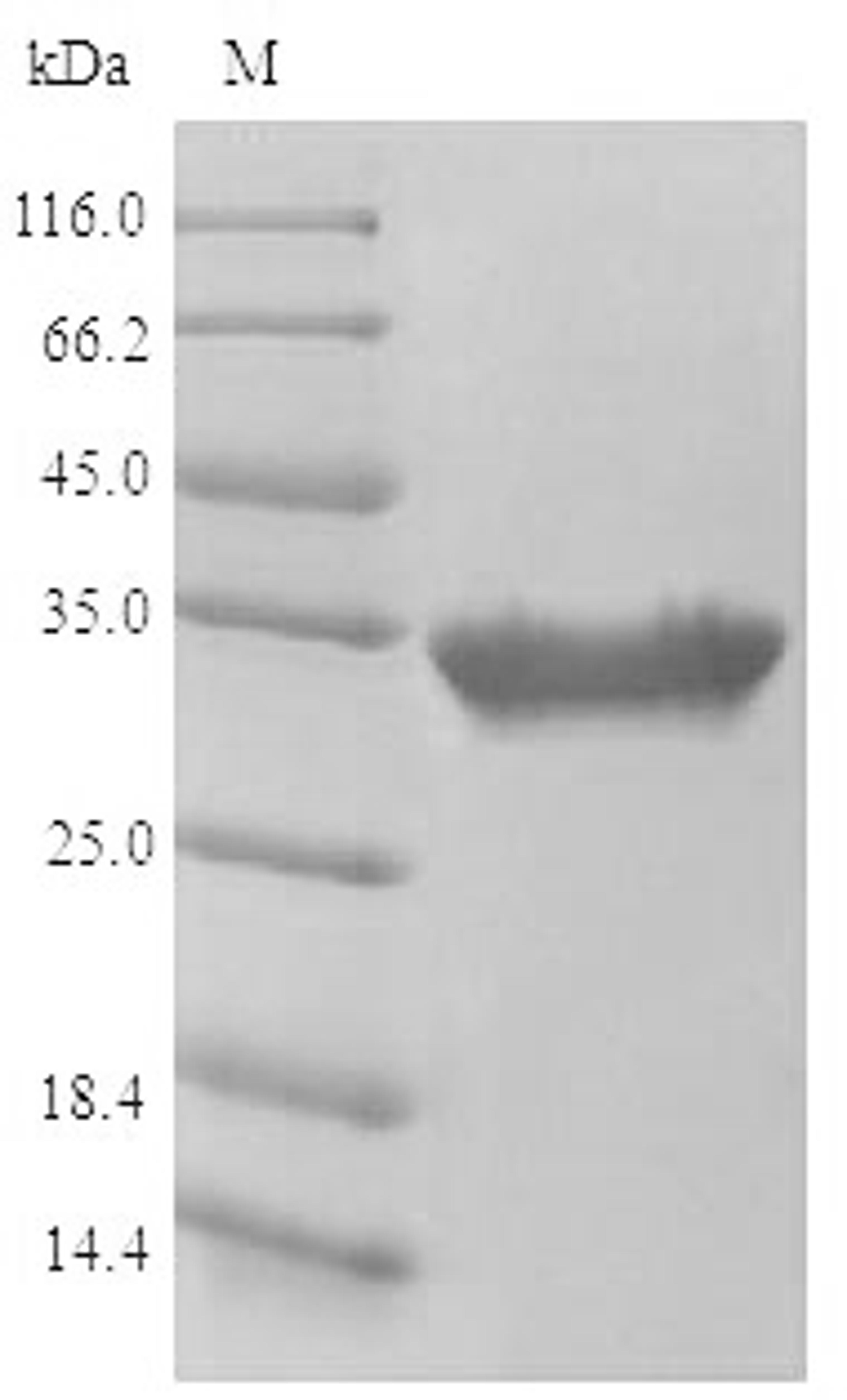 (Tris-Glycine gel) Discontinuous SDS-PAGE (reduced) with 5% enrichment gel and 15% separation gel.