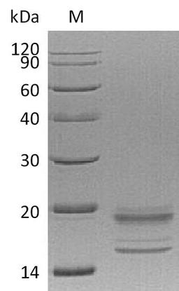 (Tris-Glycine gel) Discontinuous SDS-PAGE (reduced) with 5% enrichment gel and 15% separation gel.