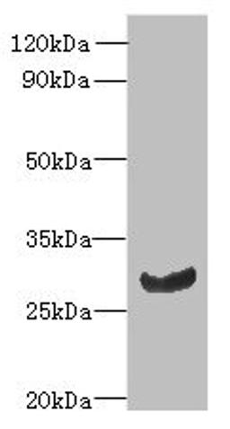Western blot. All lanes: C11orf68 antibody at 3µg/ml + Mouse liver tissue. Secondary. Goat polyclonal to rabbit IgG at 1/10000 dilution. Predicted band size: 28, 32 kDa. Observed band size: 28 kDa
