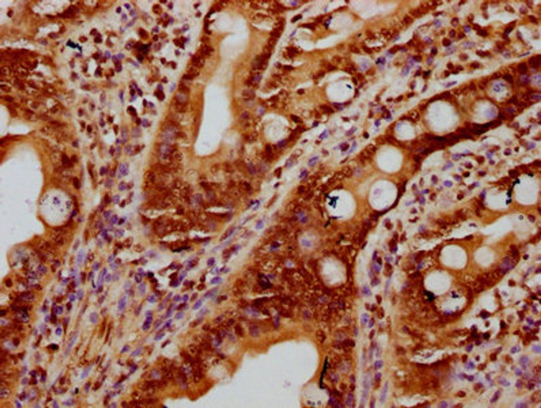IHC image of CSB-PA010403OA11nbhbHU diluted at 1:10 and staining in paraffin-embedded human small intestine tissue performed on a Leica BondTM system. After dewaxing and hydration, antigen retrieval was mediated by high pressure in a citrate buffer (pH 6.0). Section was blocked with 10% normal goat serum 30min at RT. Then primary antibody (1% BSA) was incubated at 4&deg;C overnight. The primary is detected by a biotinylated secondary antibody and visualized using an HRP conjugated SP system.