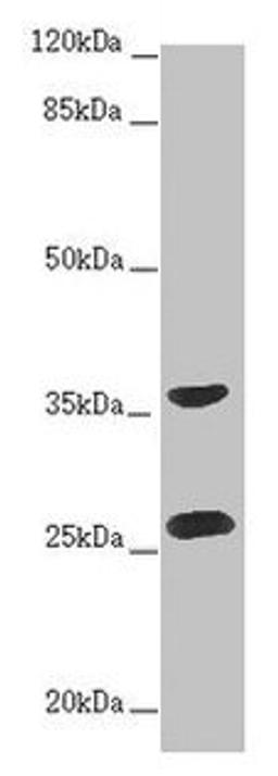 Western blot. All lanes: RAB12 antibody at 2ug/ml + Hela whole cell lysate. Secondary. Goat polyclonal to rabbit IgG at 1/10000 dilution. Predicted band size: 28 kDa. Observed band size: 28, 36 kDa. 