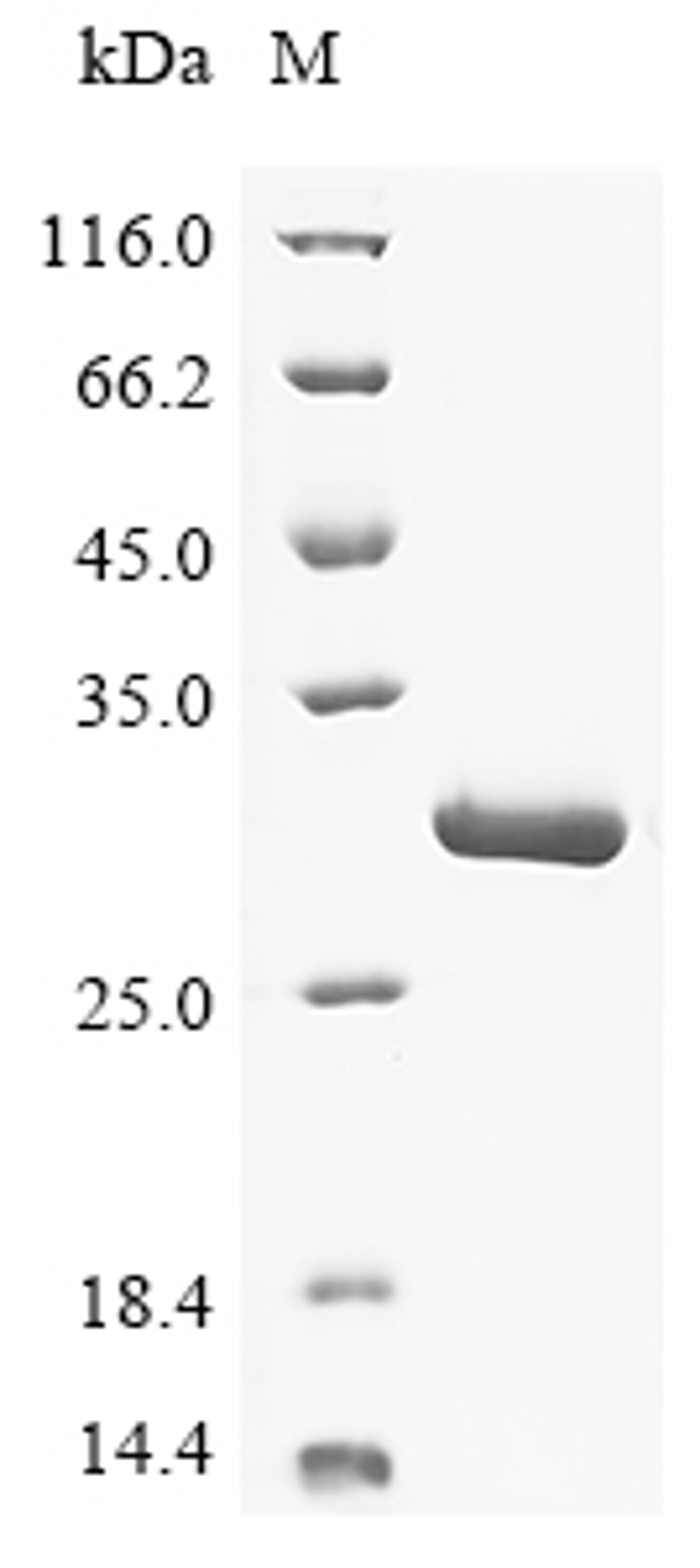(Tris-Glycine gel) Discontinuous SDS-PAGE (reduced) with 5% enrichment gel and 15% separation gel.