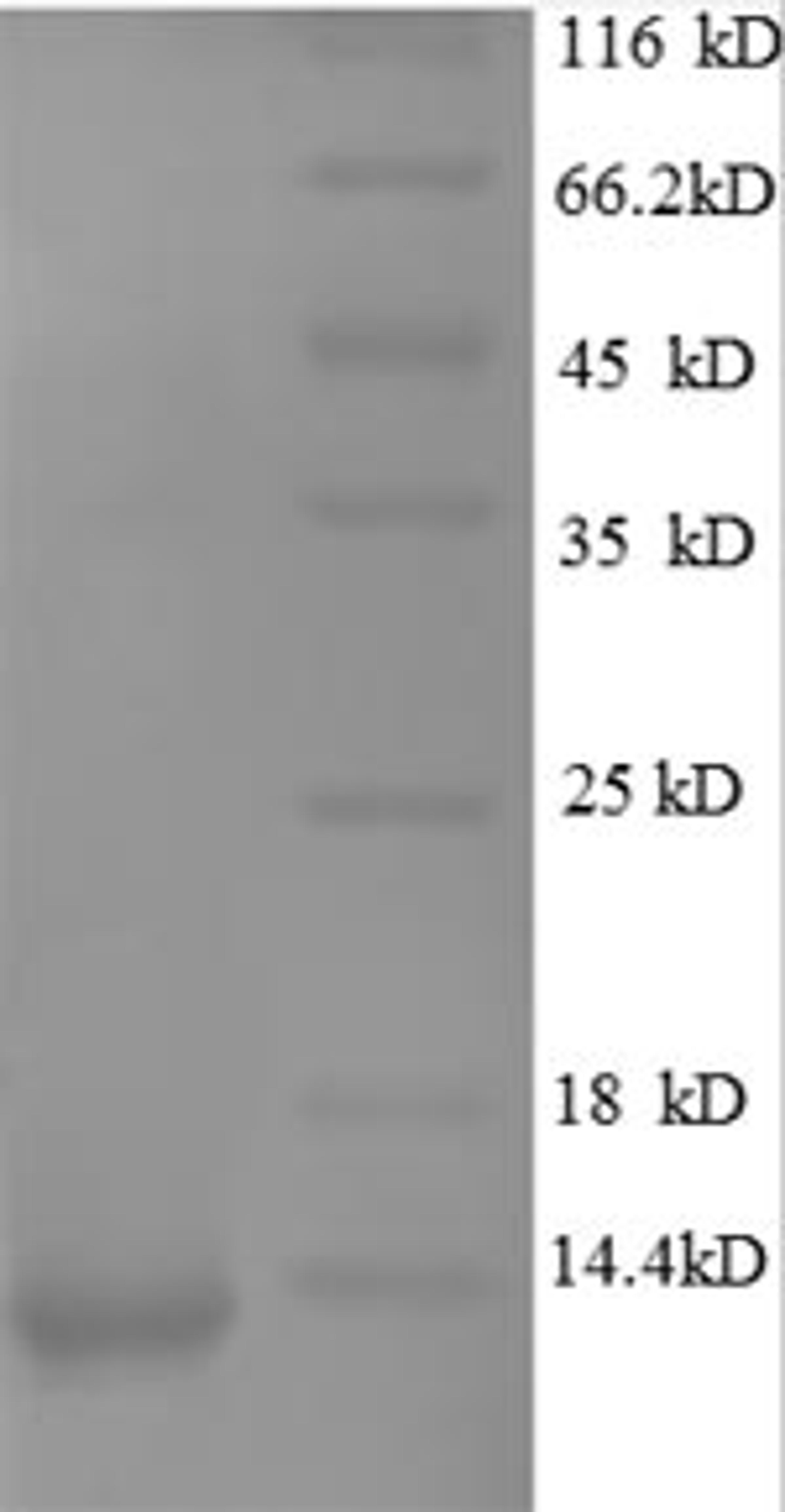 (Tris-Glycine gel) Discontinuous SDS-PAGE (reduced) with 5% enrichment gel and 15% separation gel.