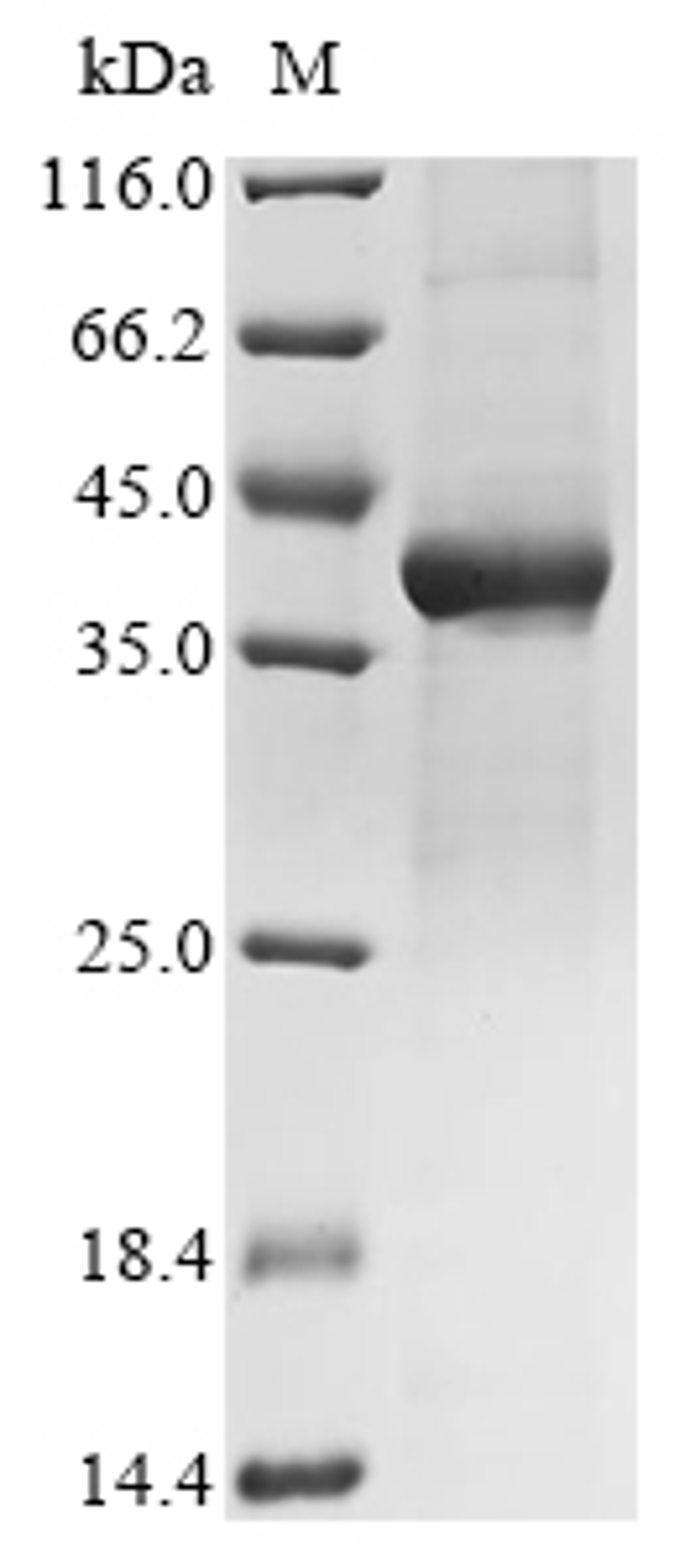 (Tris-Glycine gel) Discontinuous SDS-PAGE (reduced) with 5% enrichment gel and 15% separation gel.